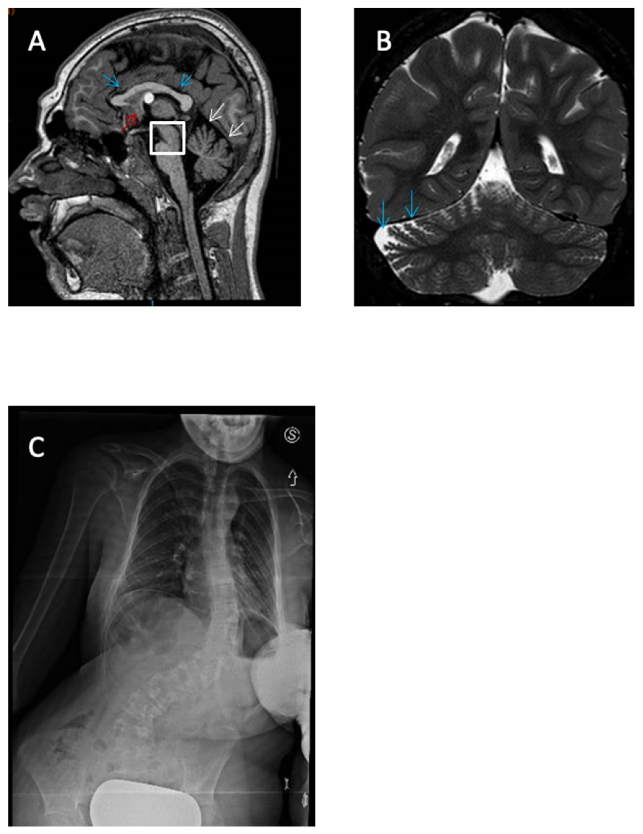 Genes 13 00276 g004 550