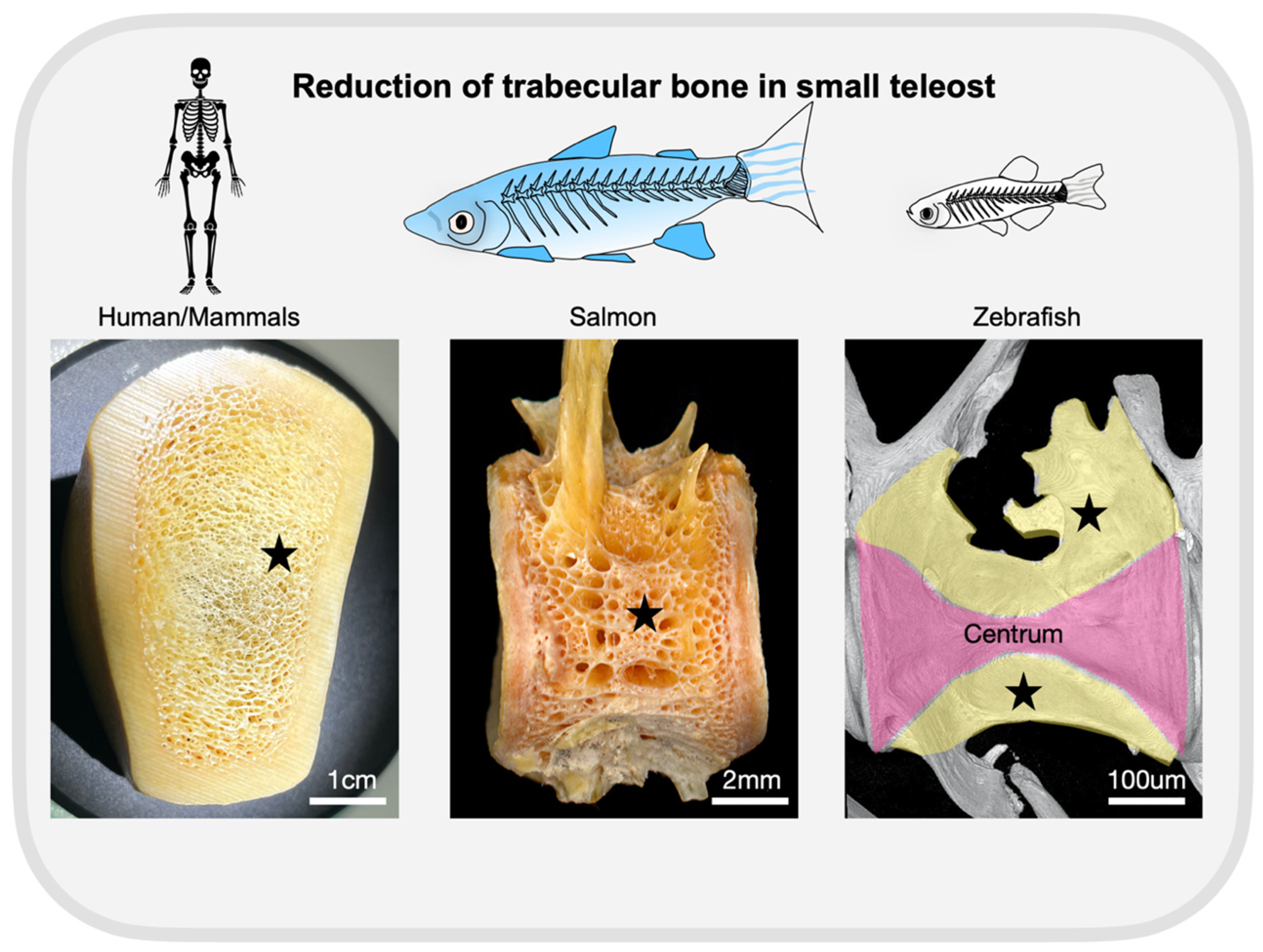 Genes | Free Full-Text | Functional Validation of Osteoporosis Genetic Findings Using Small Fish Models Genes | Free Full-Text | Functional Validation of Osteoporosis Genetic Findings Using Small Fish Models