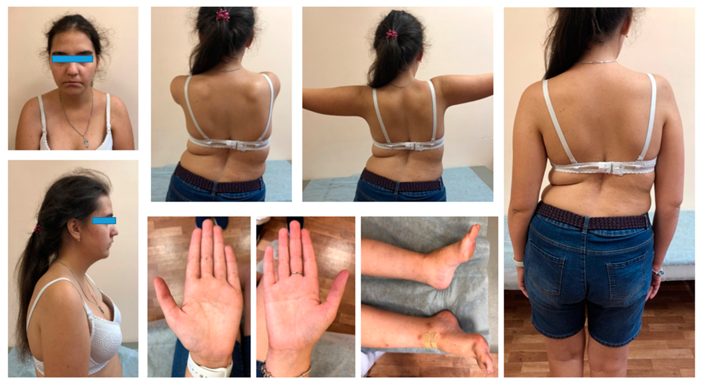 Genes 13 00341 g001 550