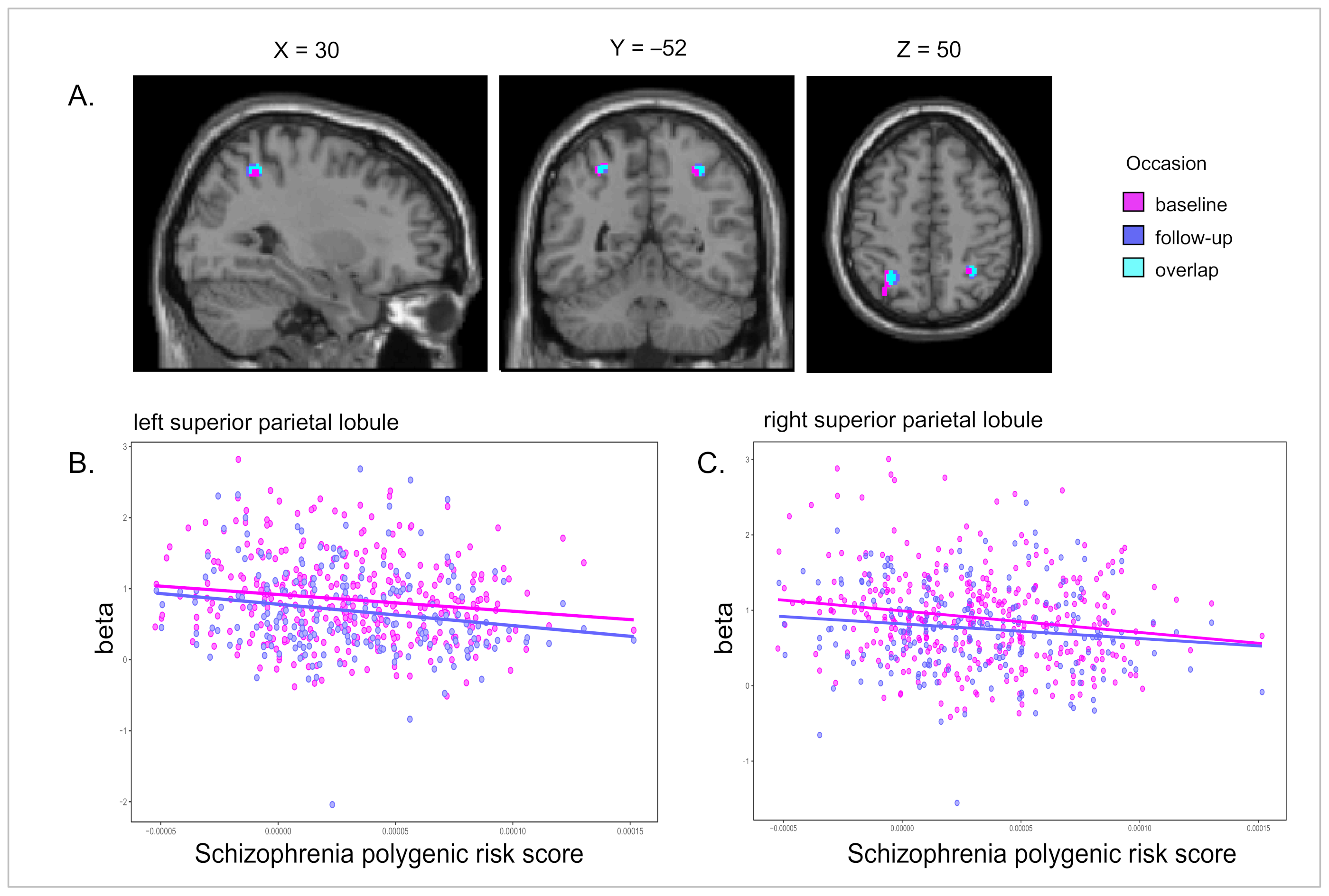 Results of whole brain analyses in the test scan. a The left parietal