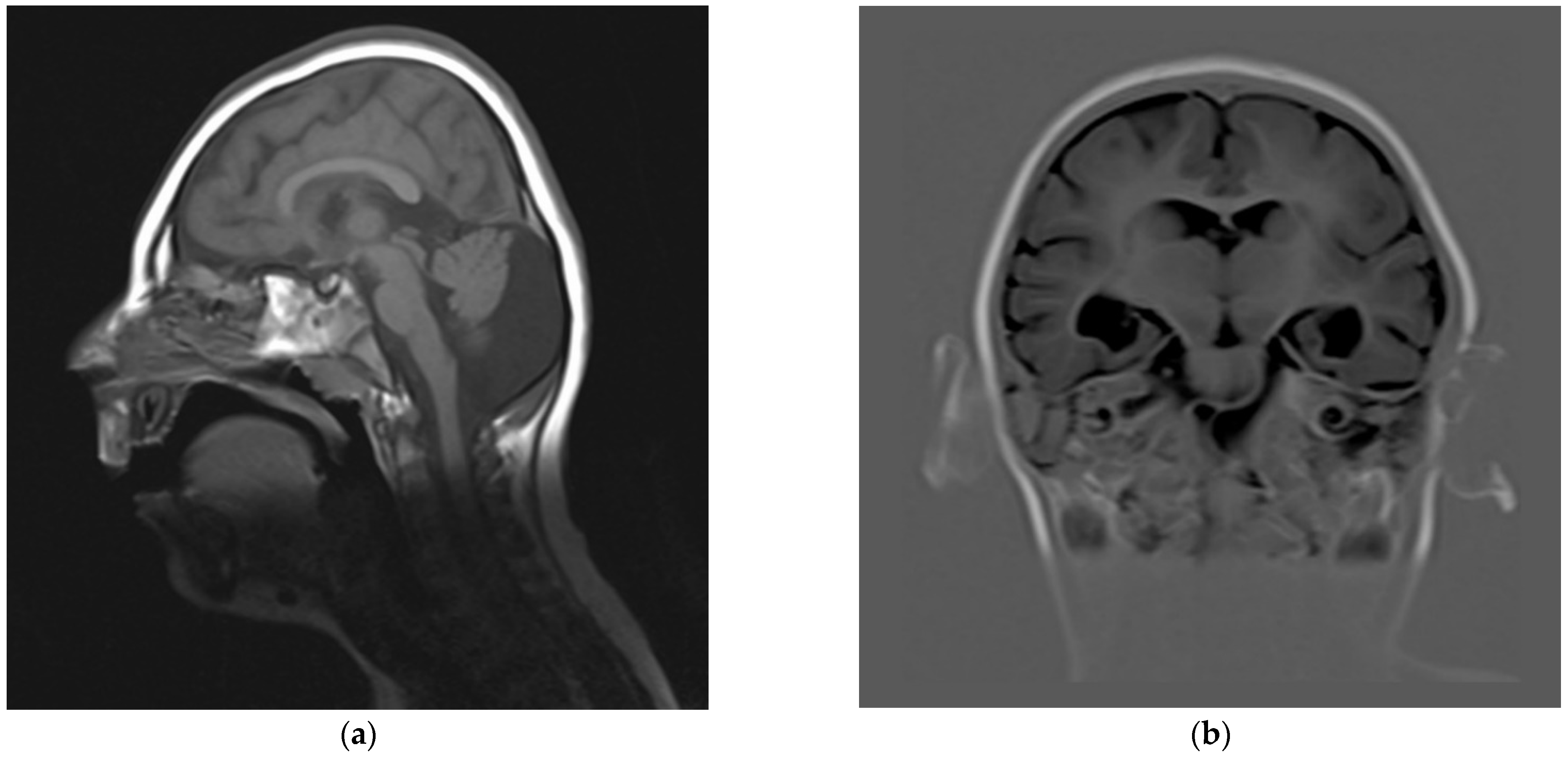 Genes 13 00634 g002a