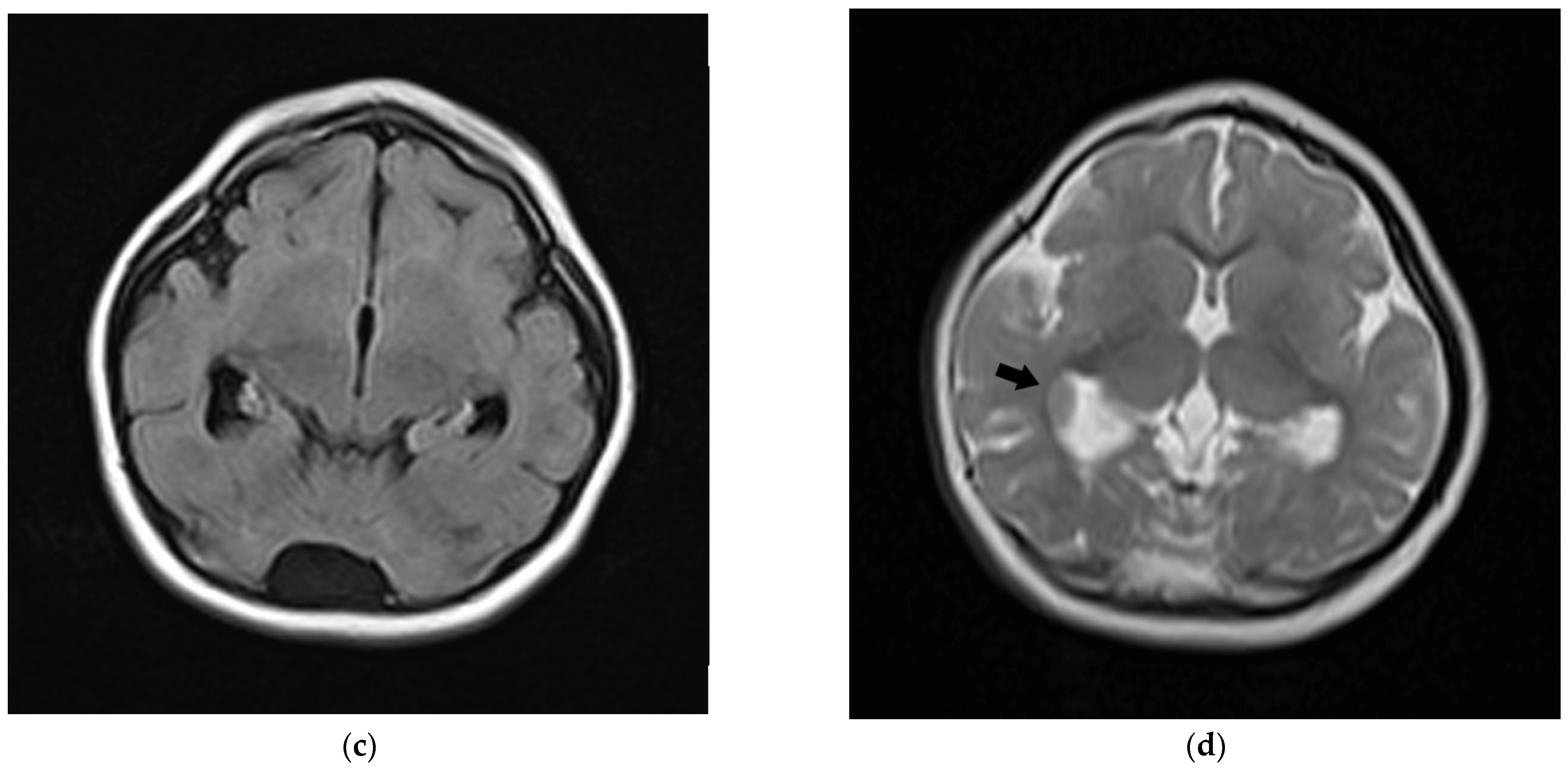 Genes 13 00634 g002b