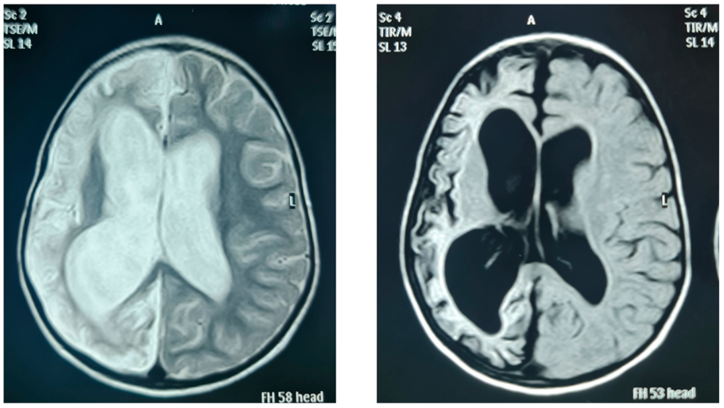 Genes 13 00657 g002 Genes 13 00657 g002