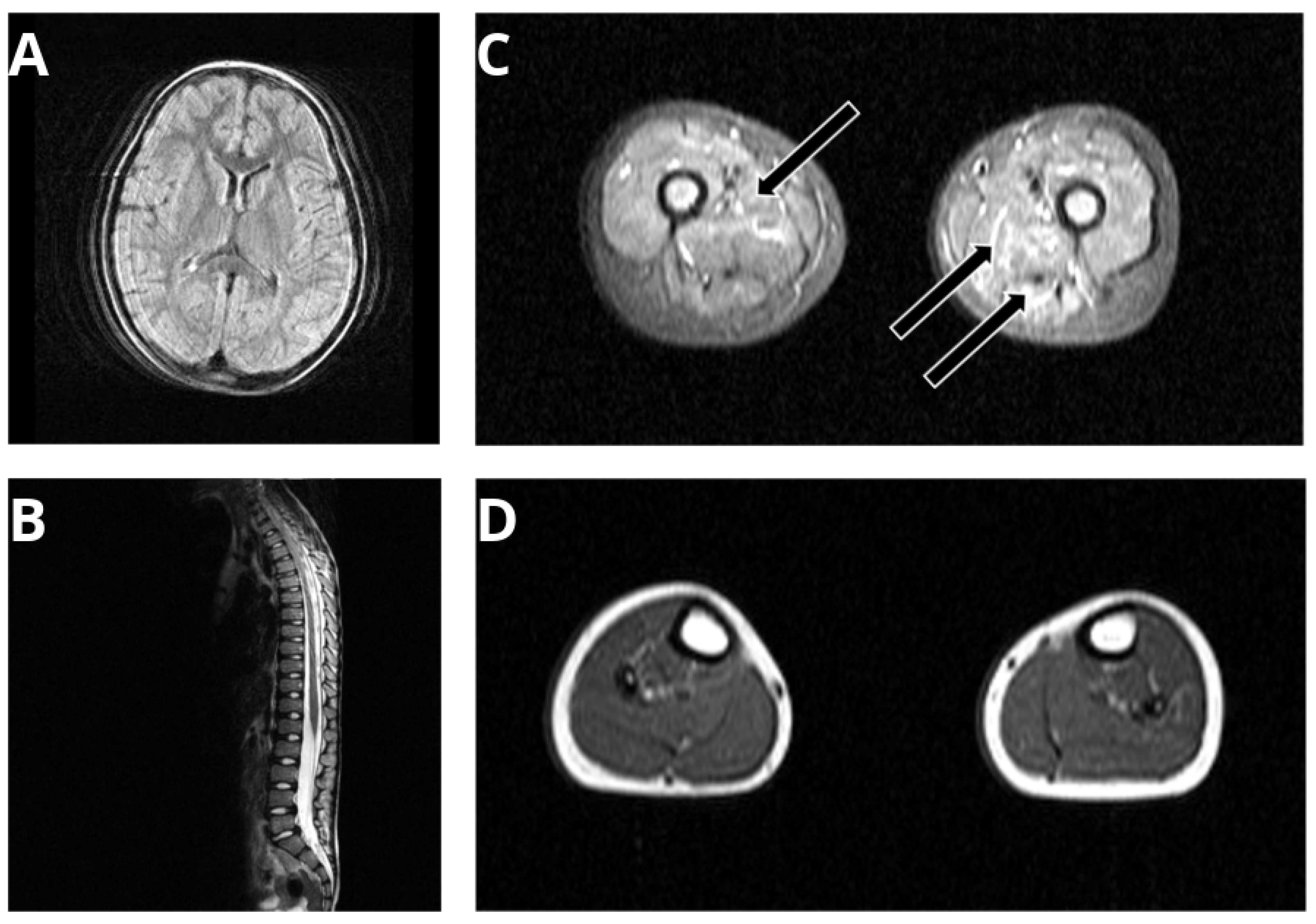 Genes 13 00893 g001 Genes 13 00893 g001