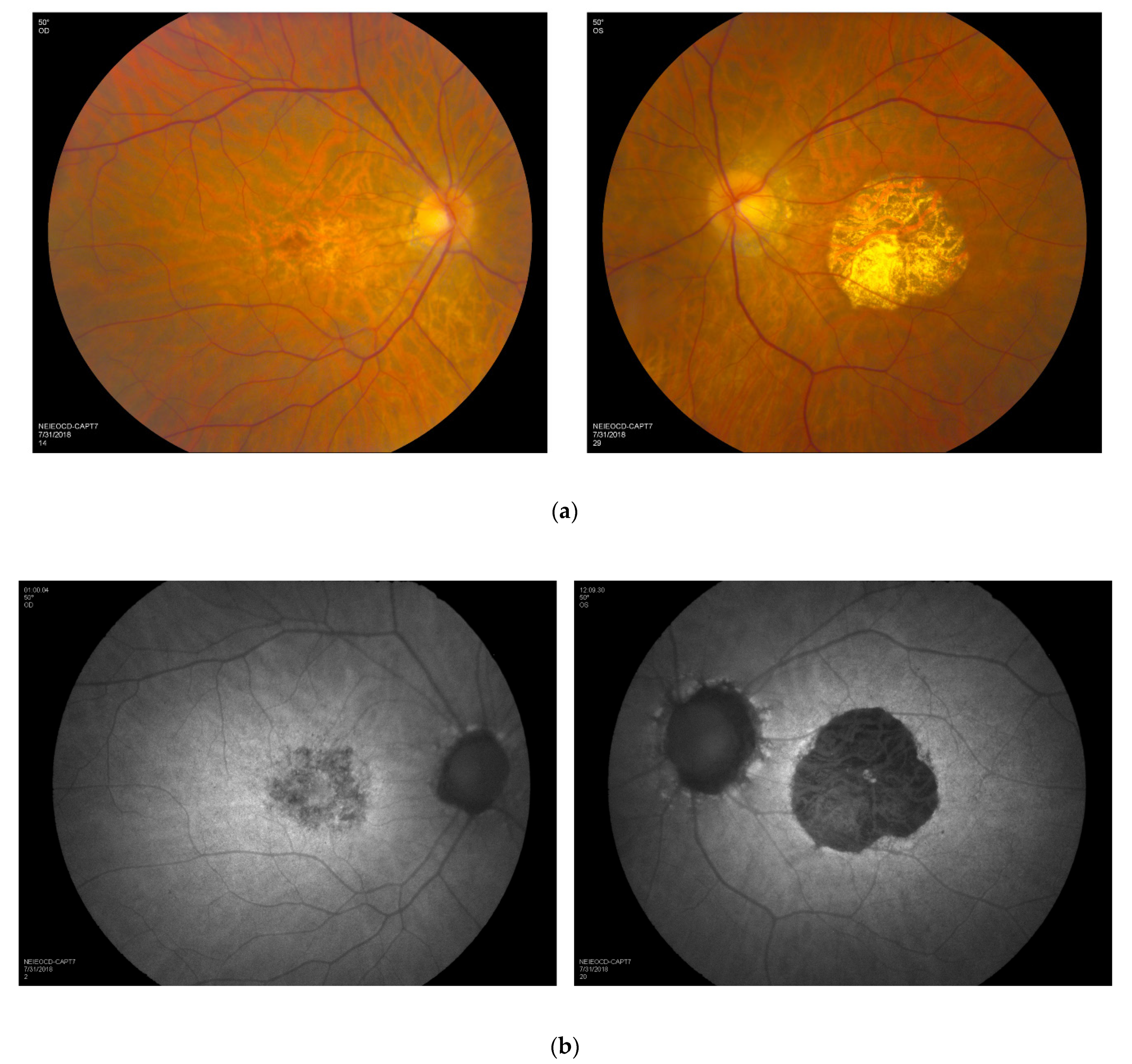 Genes 13 00925 g002 550