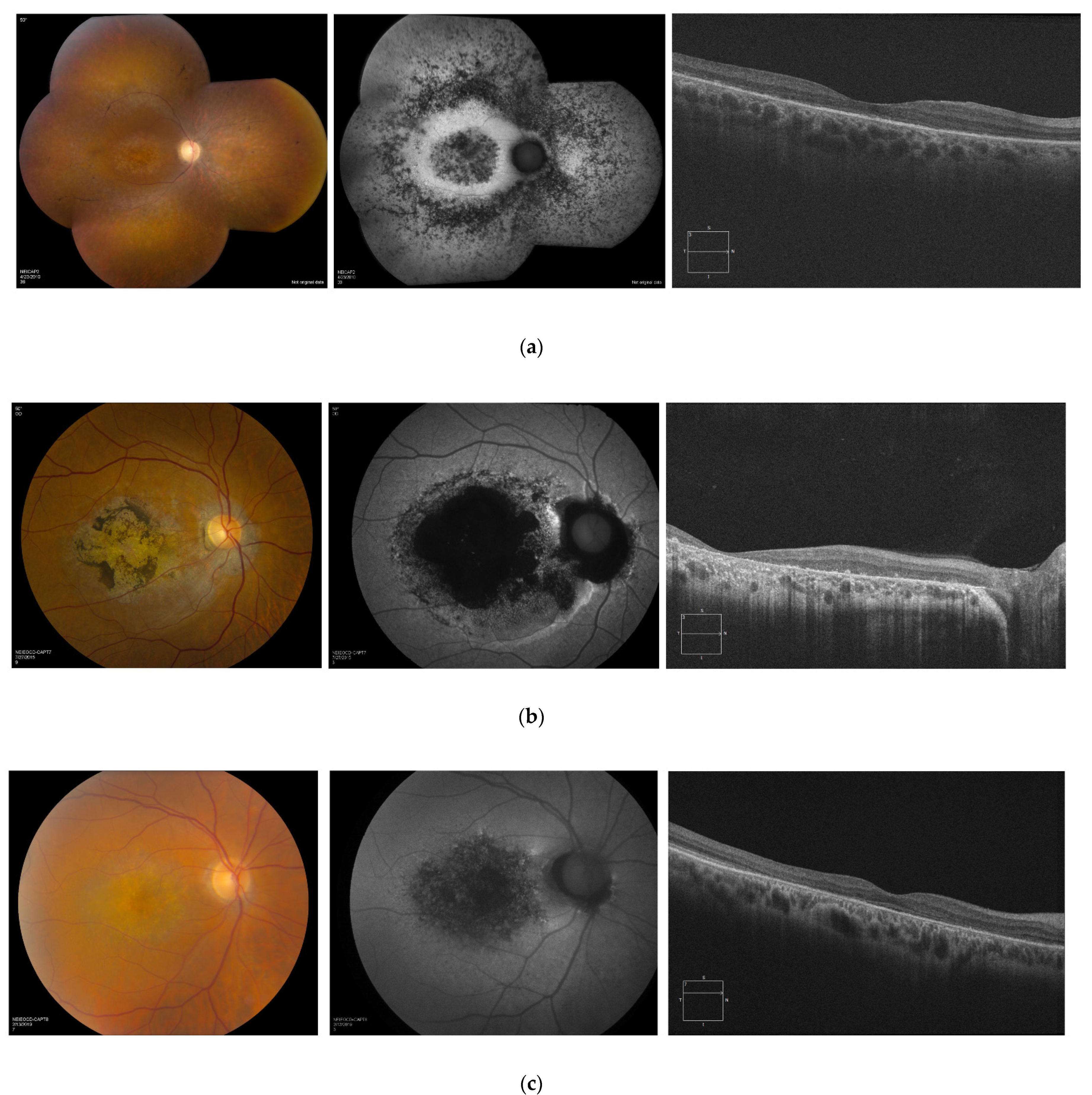 Genes 13 00925 g003 550