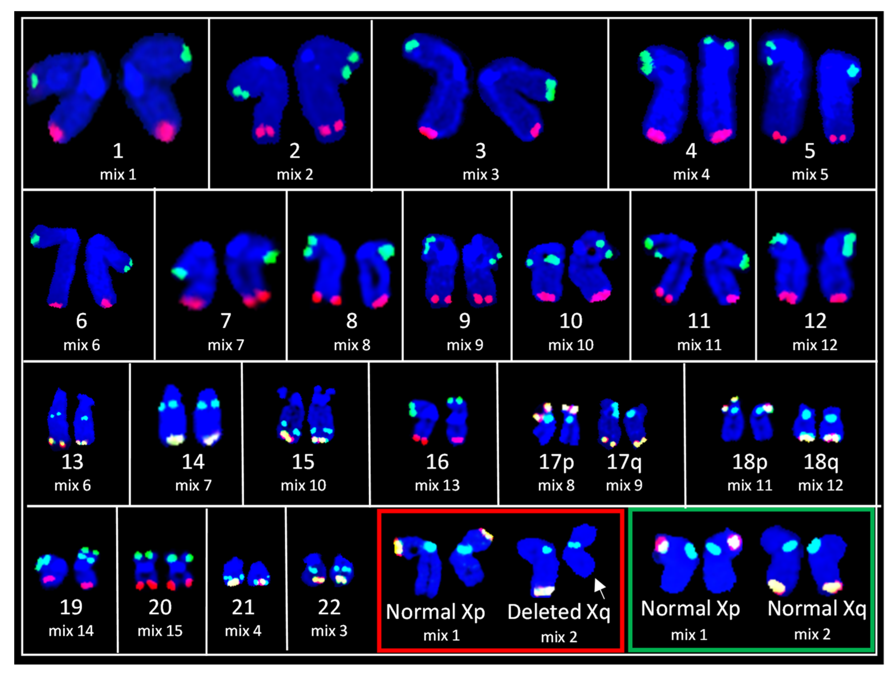 Genes 13 01012 g002 550