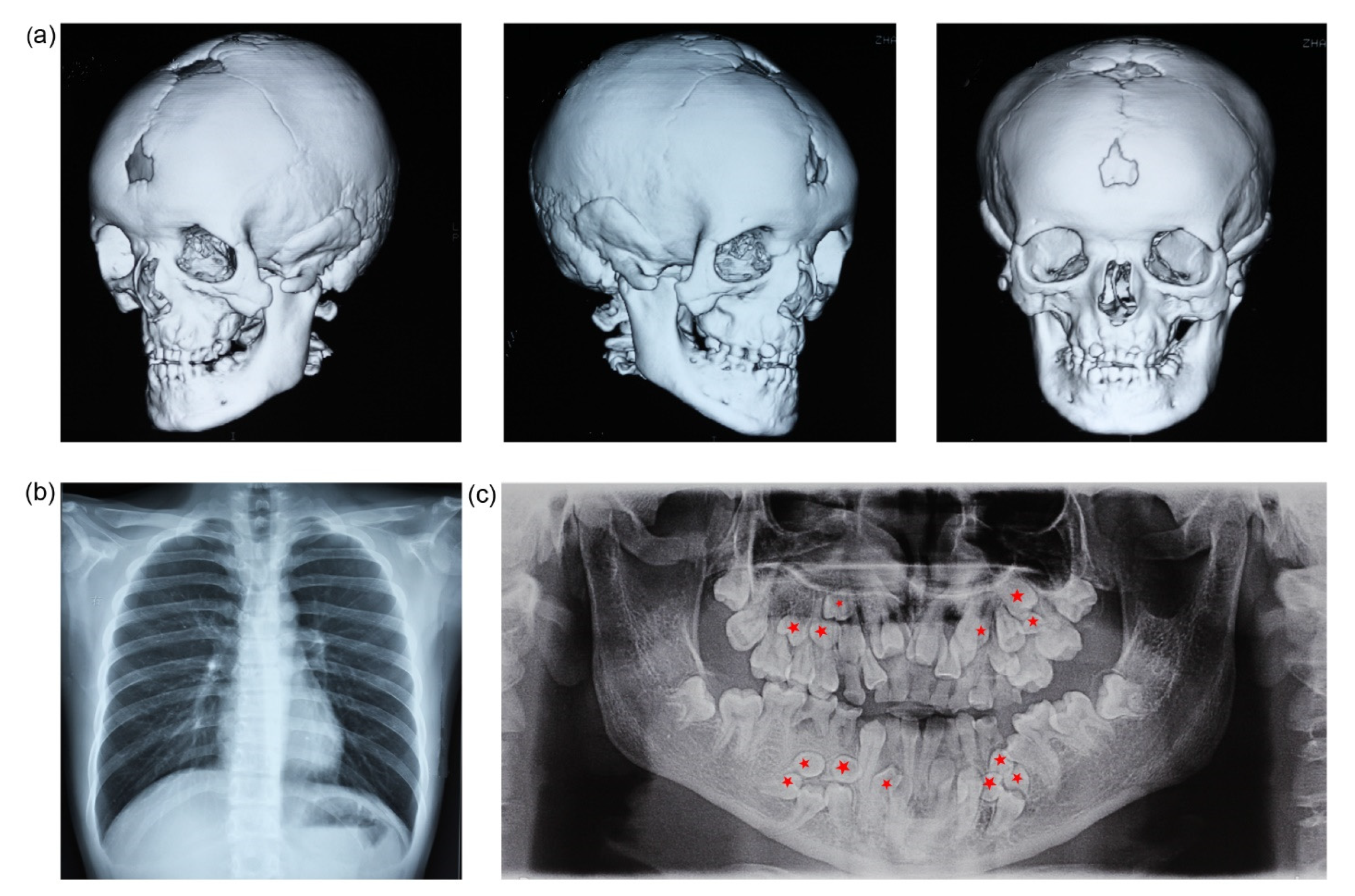 Genes 13 01128 g001 Genes 13 01128 g001