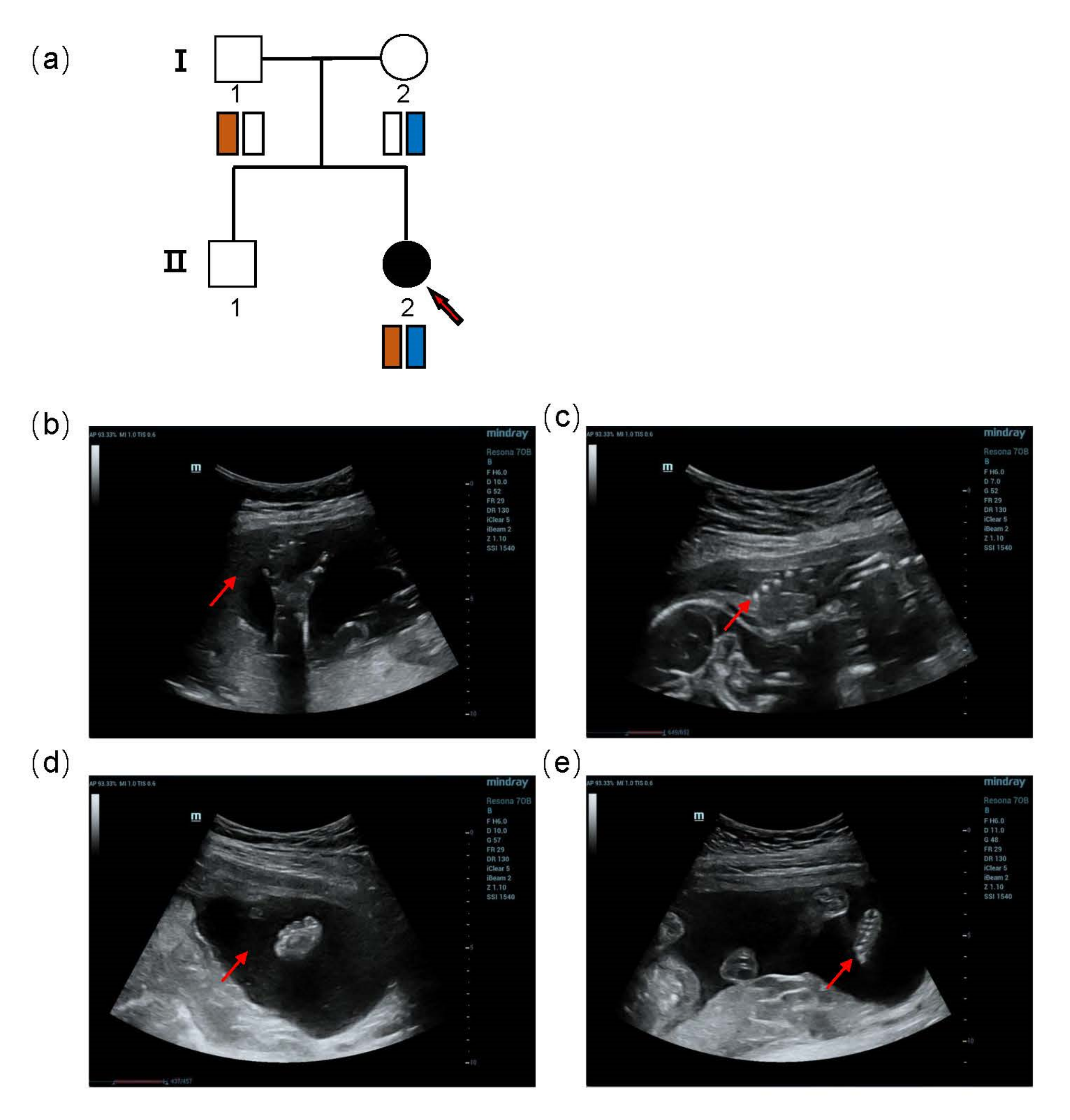 Genes 13 01230 g001 550