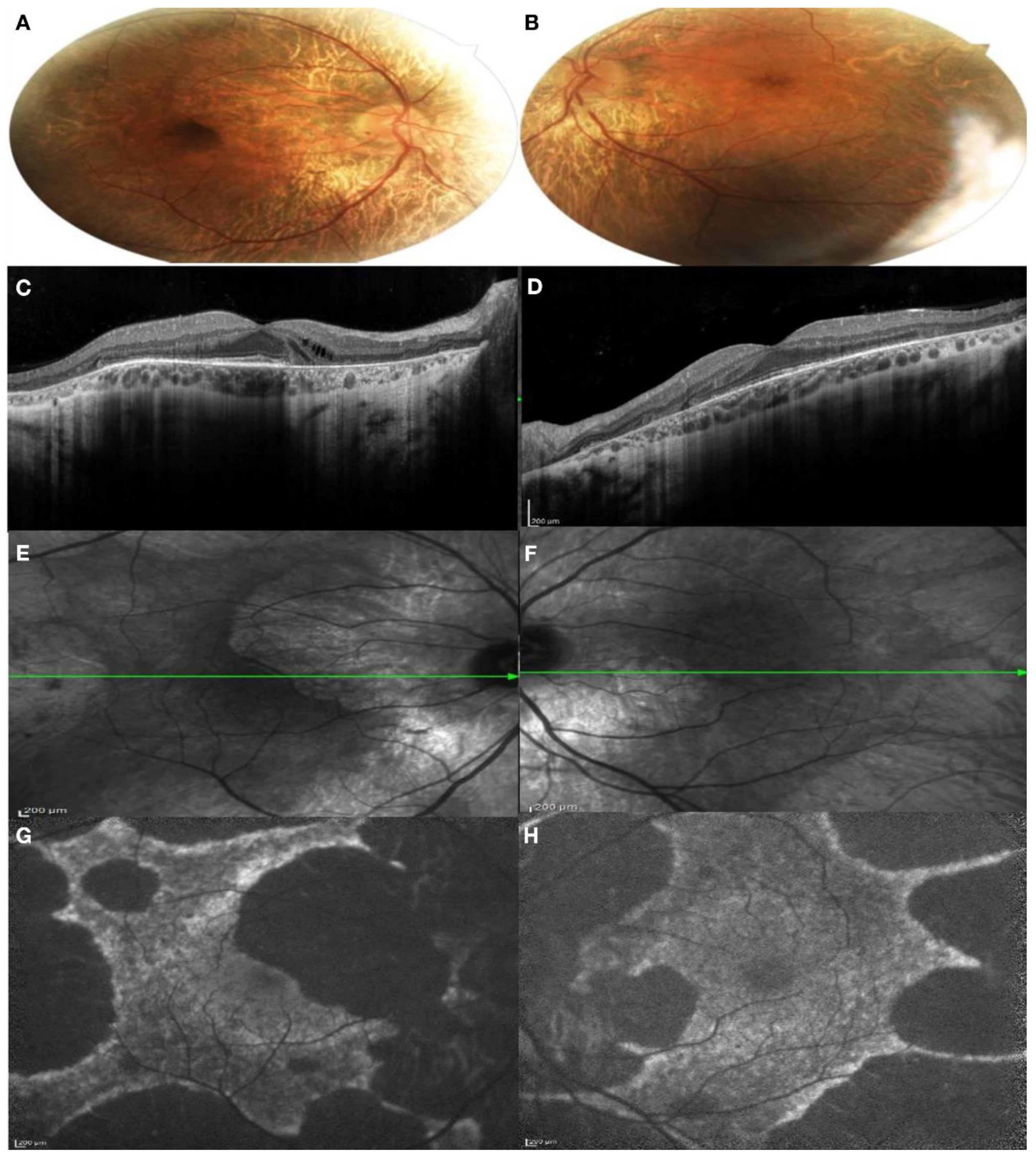 Genes 13 01268 g004 550