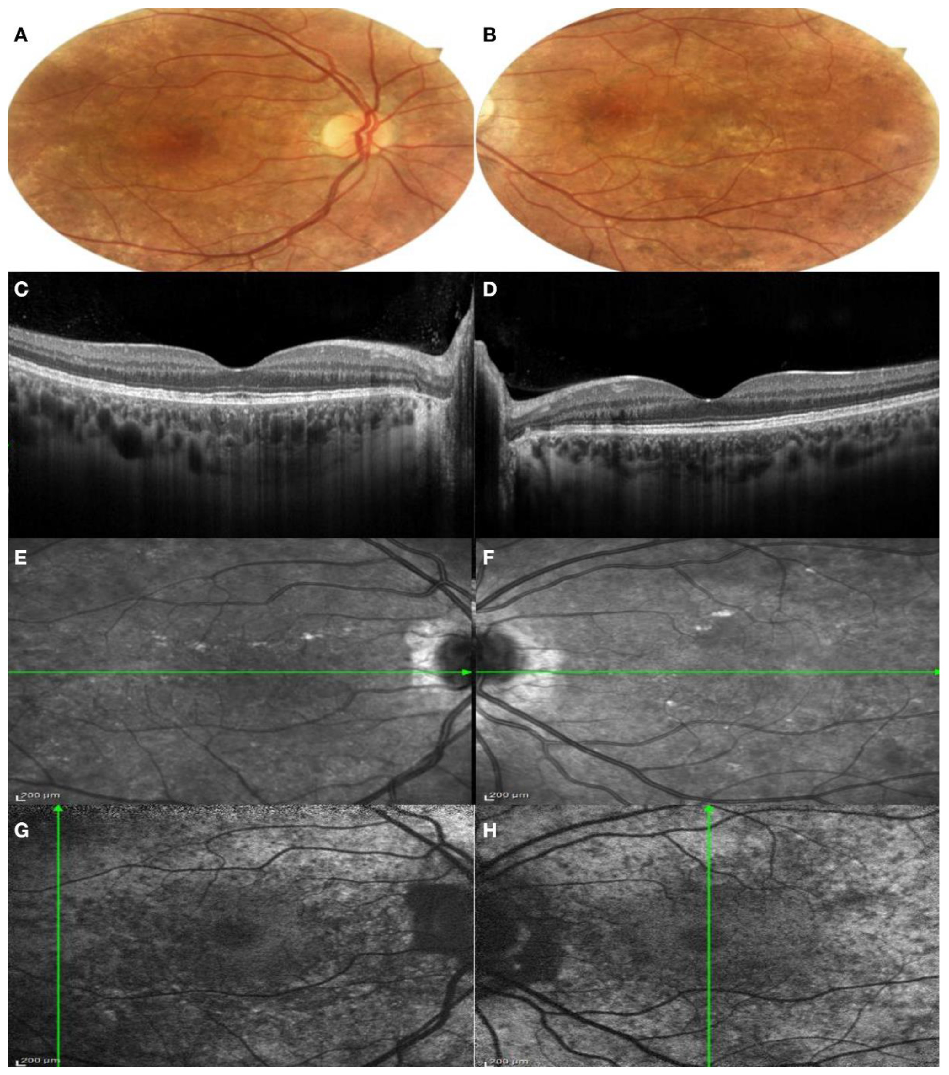 Genes 13 01268 g005 550