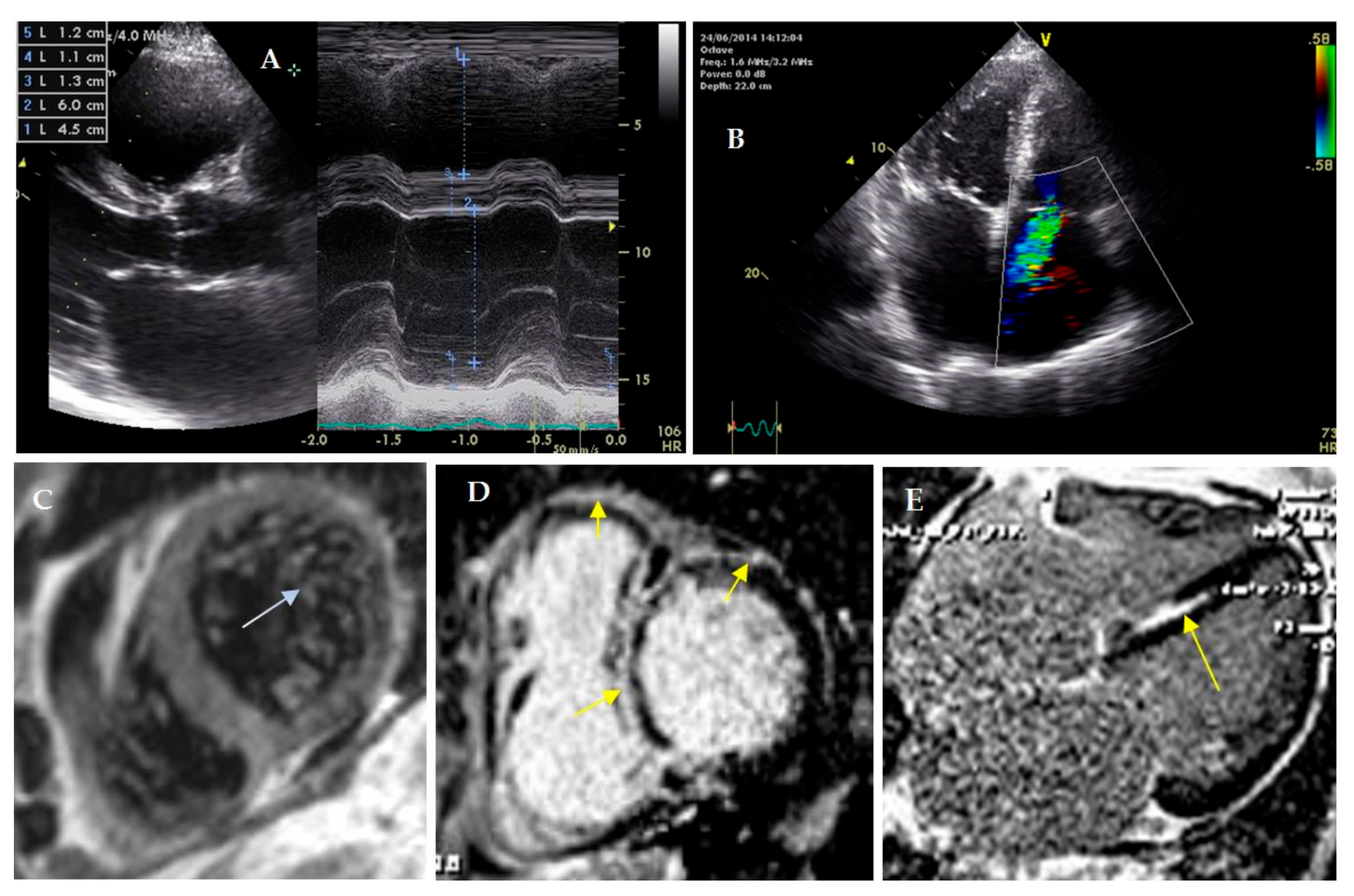 Genes 13 01344 g002 550