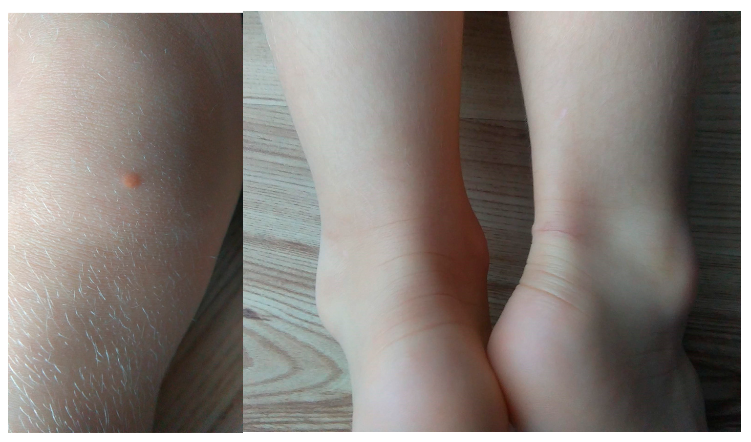 Genes 13 01424 g003 550