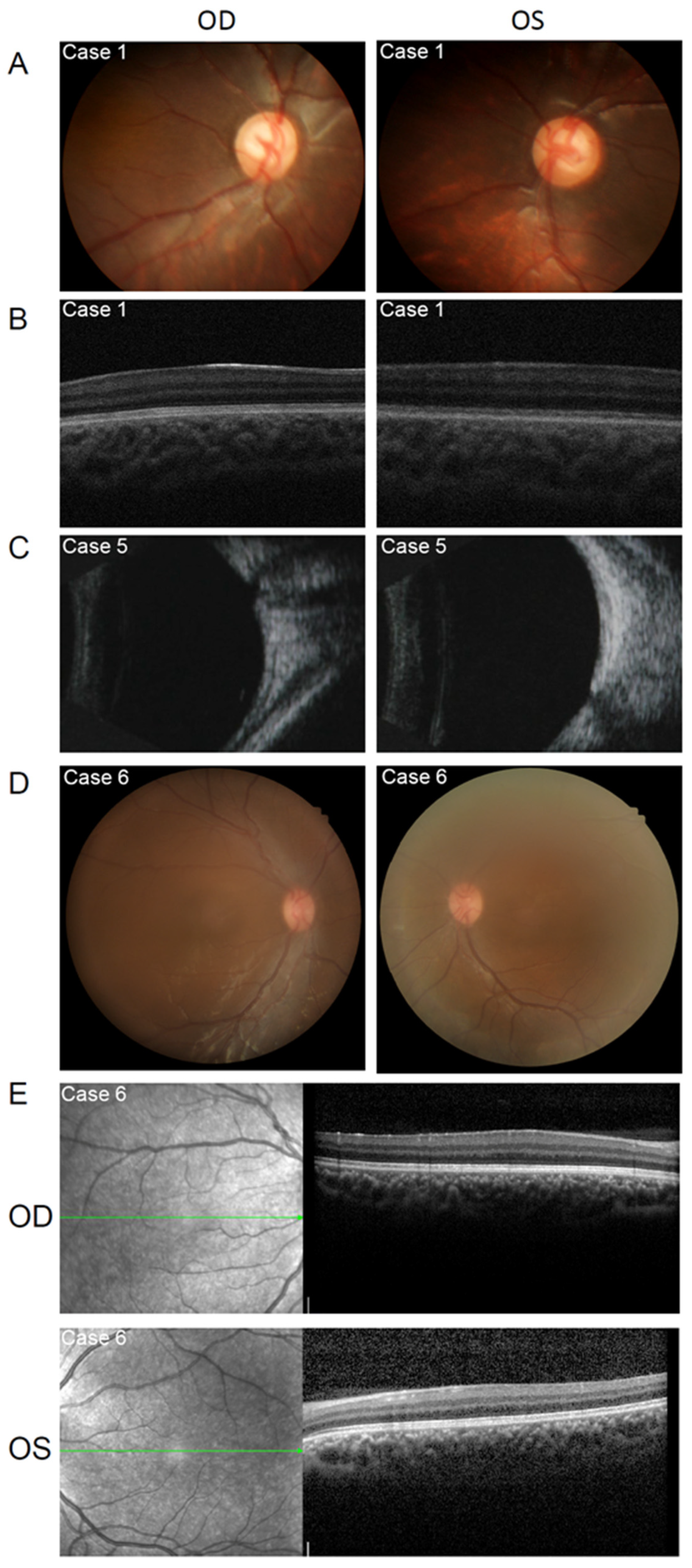 Genes 13 01431 g004 550