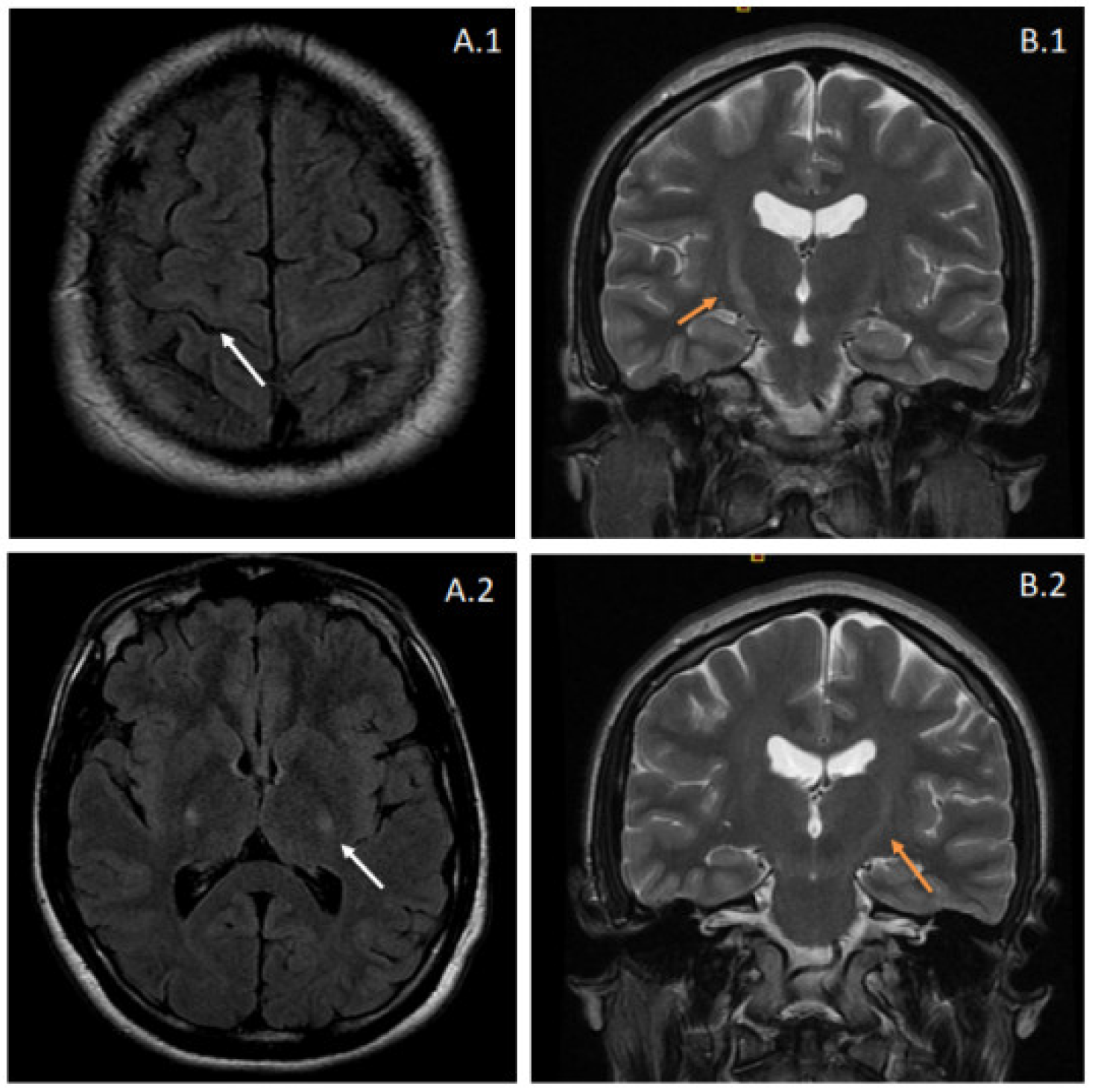 Genes 13 01483 g001 550