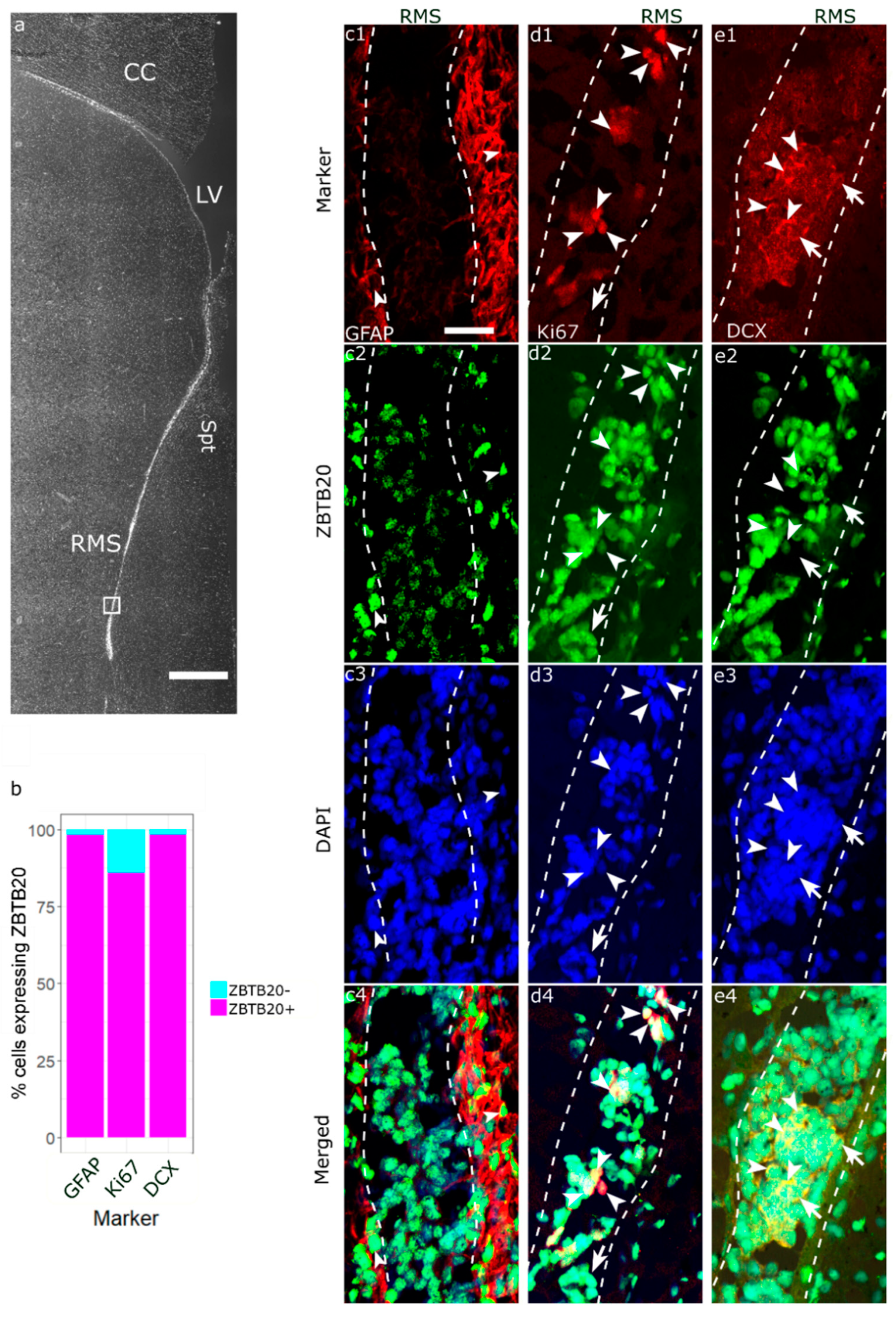 Expression of Transcription Factor ZBTB20 in the Adult