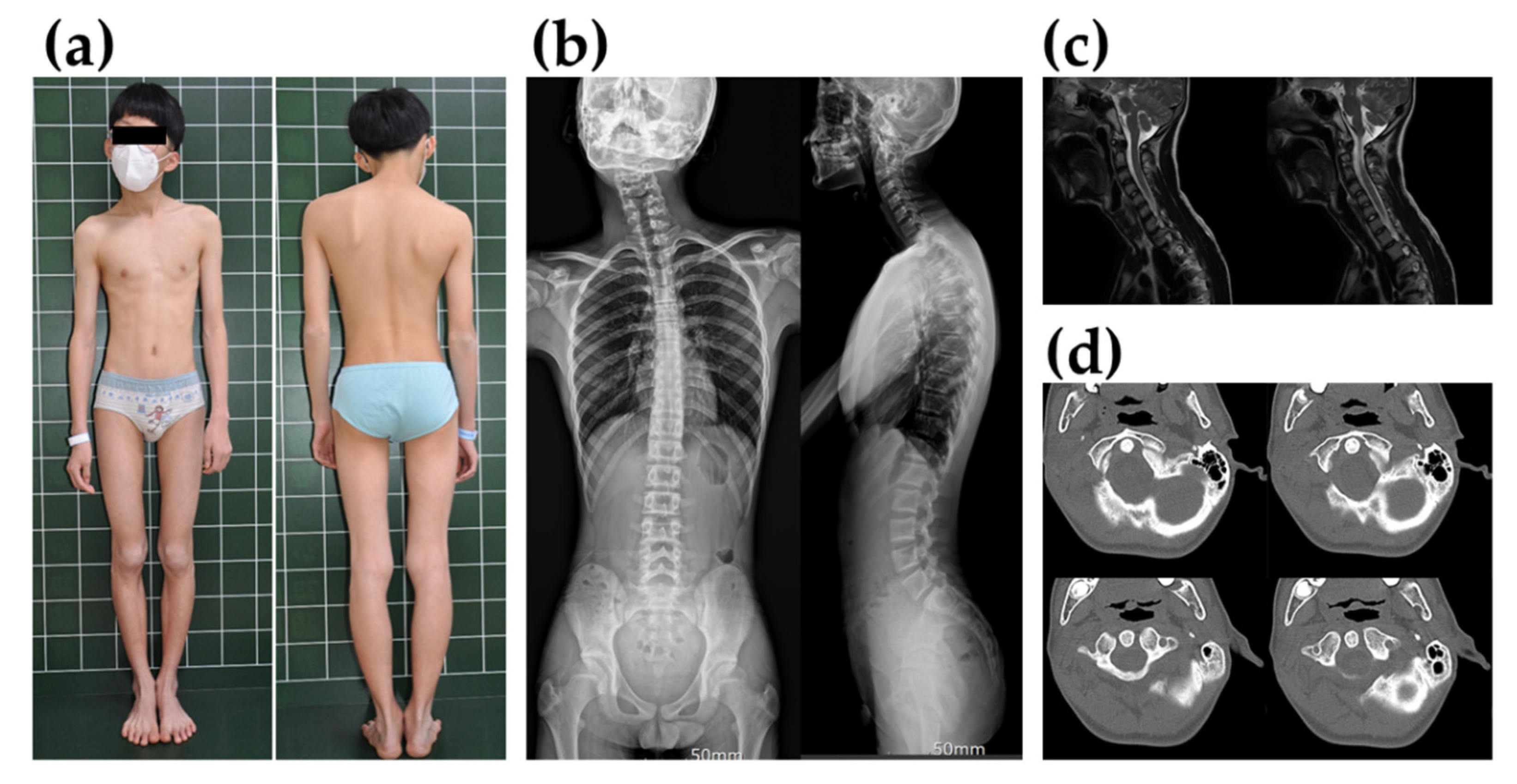 Genes 13 01726 g001 Genes 13 01726 g001