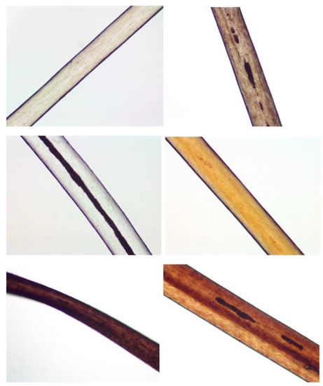 Routine Mitogenome MPS Analysis from 1 and 5 mm of Rootless Human Hair