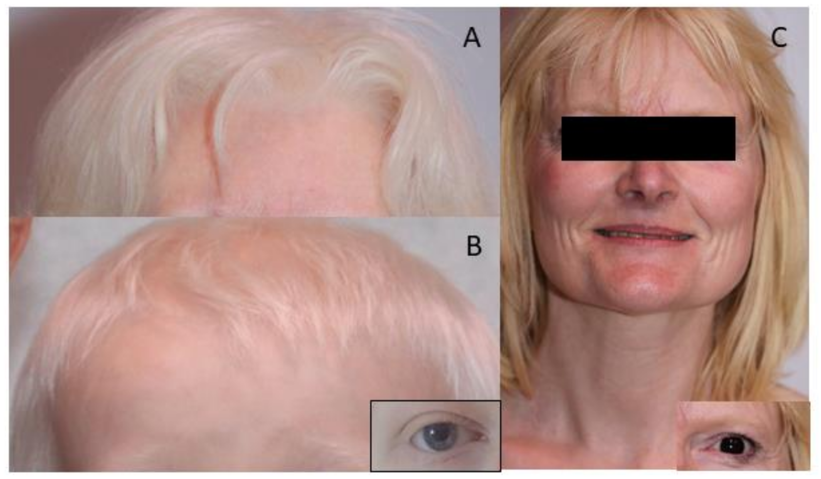 Genes 13 02198 g001 Genes 13 02198 g001