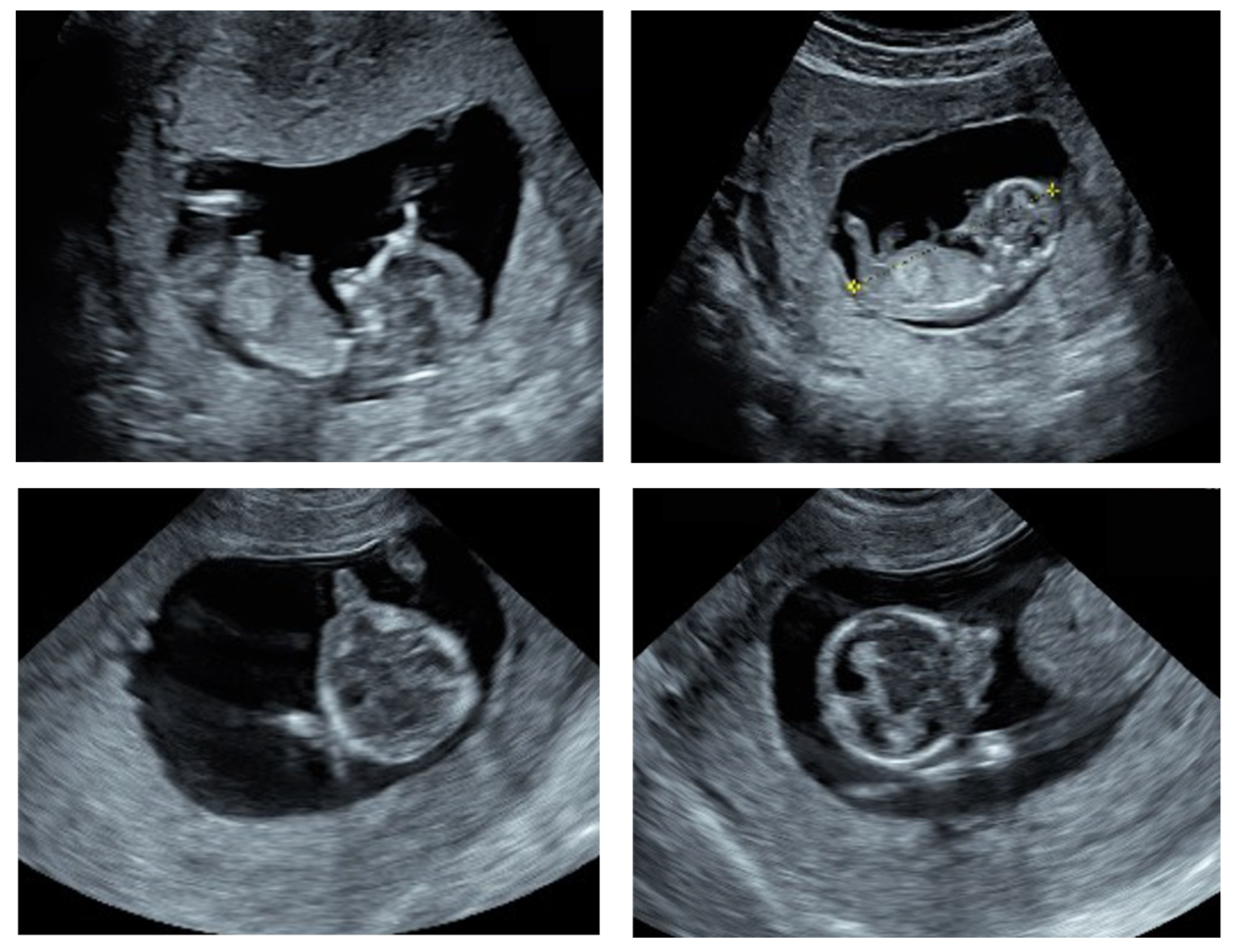 Genes 13 02269 g001 Genes 13 02269 g001