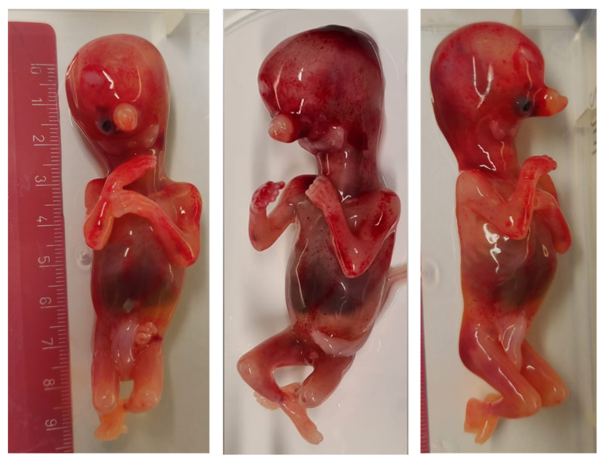 Genes 13 02269 g002 Genes 13 02269 g002