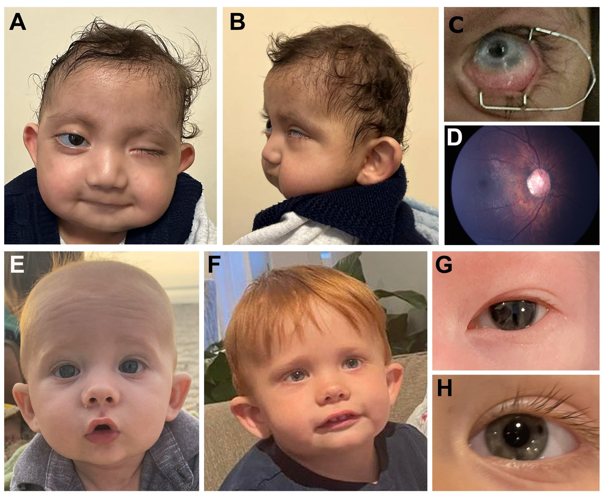 Genes 14 00216 g001 Genes 14 00216 g001
