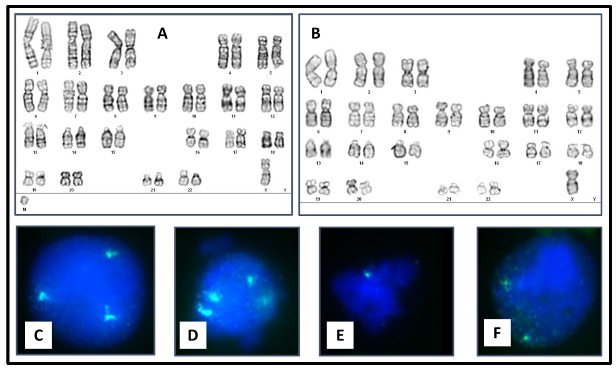 Genes Free FullText Identification of a Small Supernumerary Marker