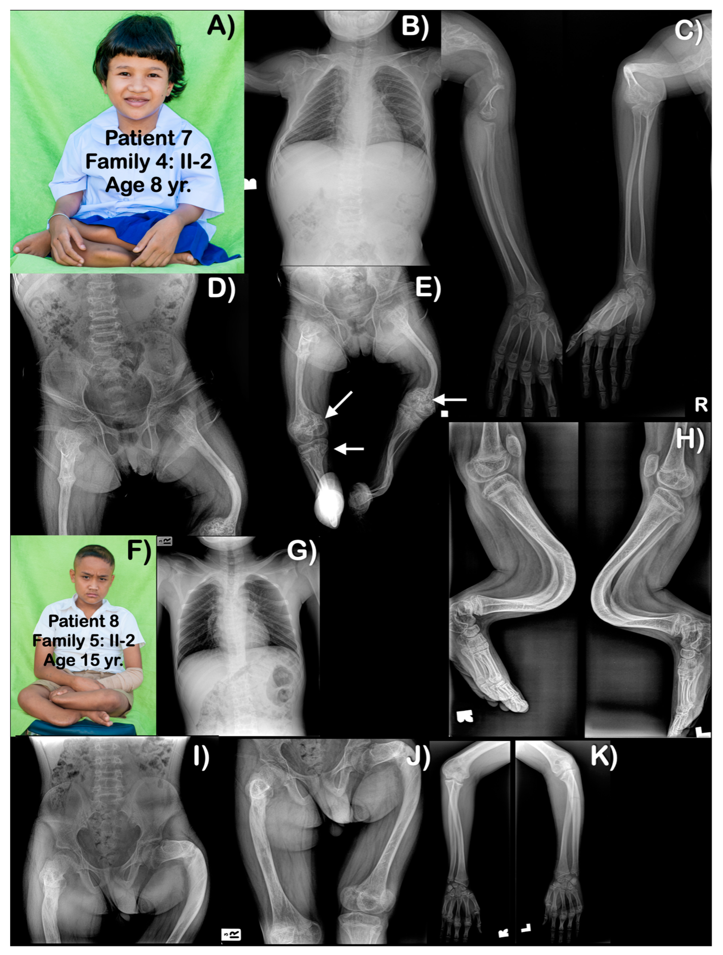 Genes 14 00322 g005 Genes 14 00322 g005