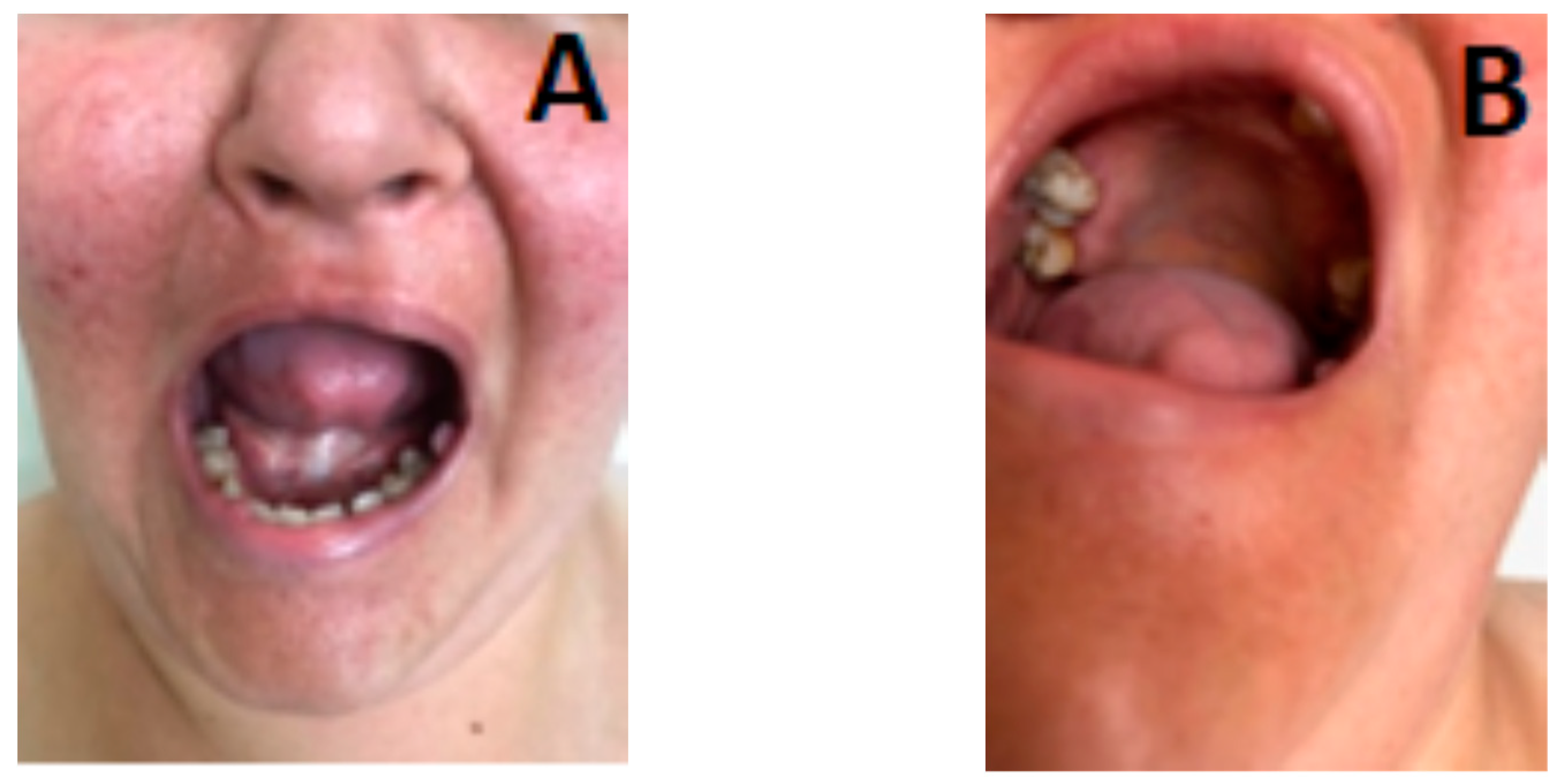 Genes 14 00433 g002 Genes 14 00433 g002