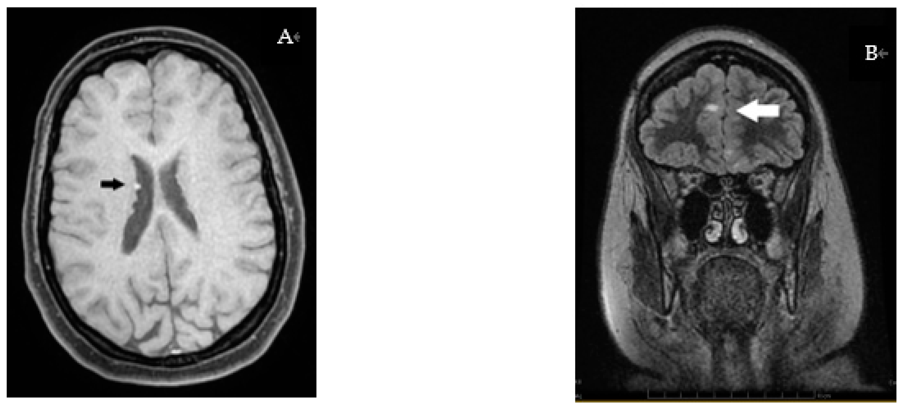 Genes 14 00433 g004 Genes 14 00433 g004