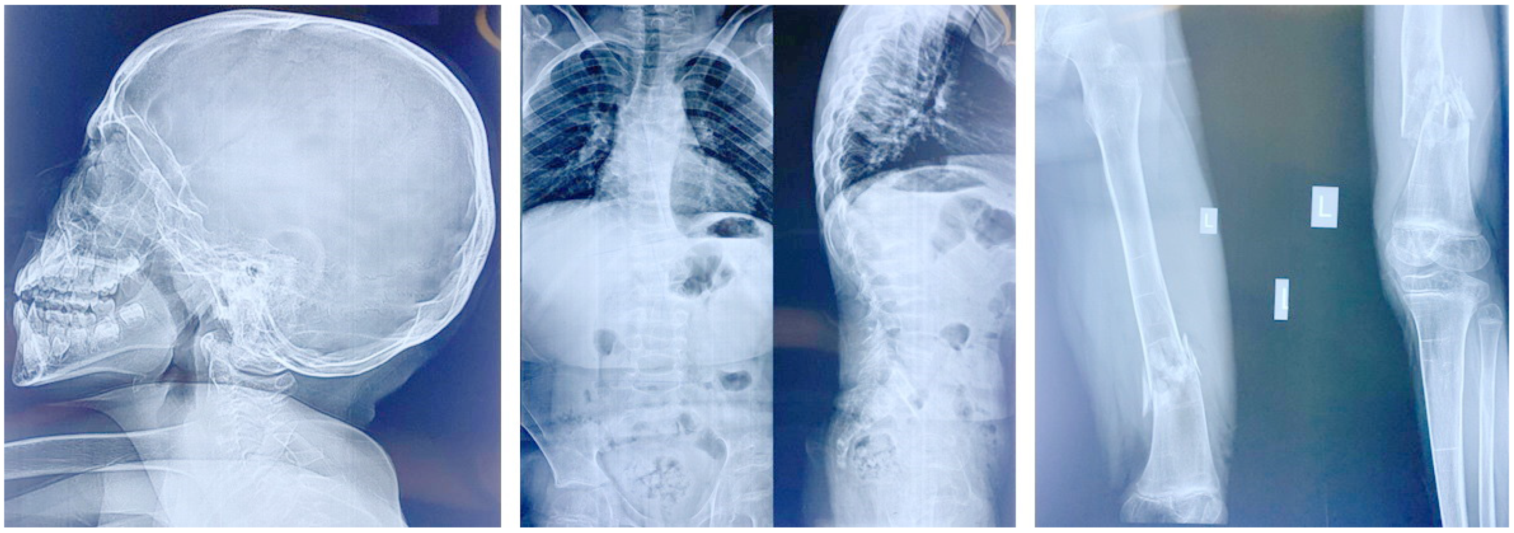 Genes 14 00497 g002 Genes 14 00497 g002