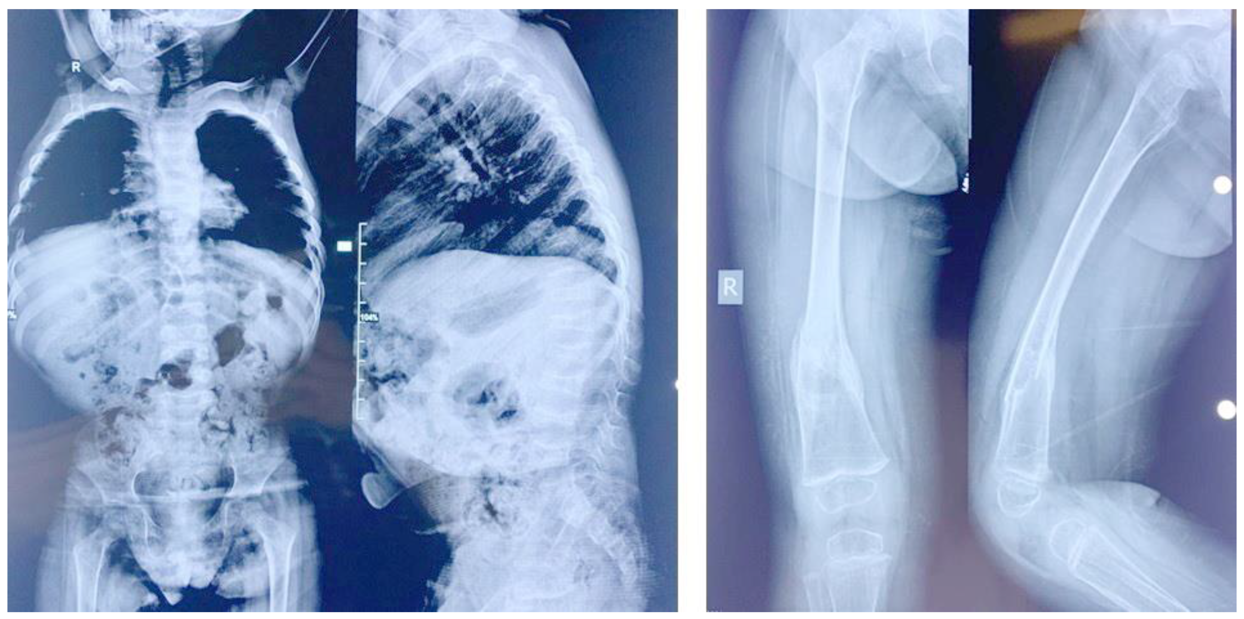 Genes 14 00497 g003 Genes 14 00497 g003