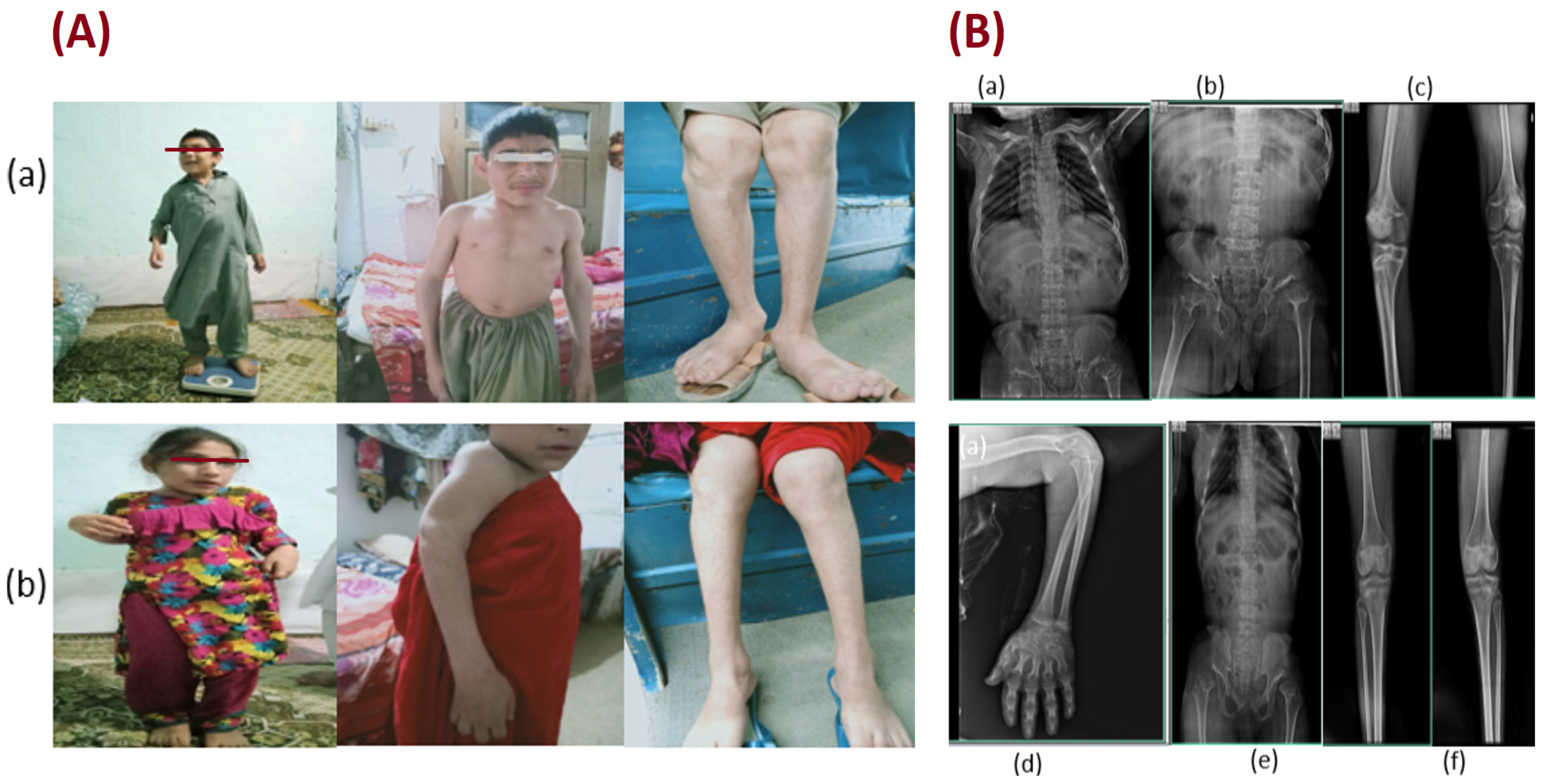 Genes 14 00510 g001 Genes 14 00510 g001