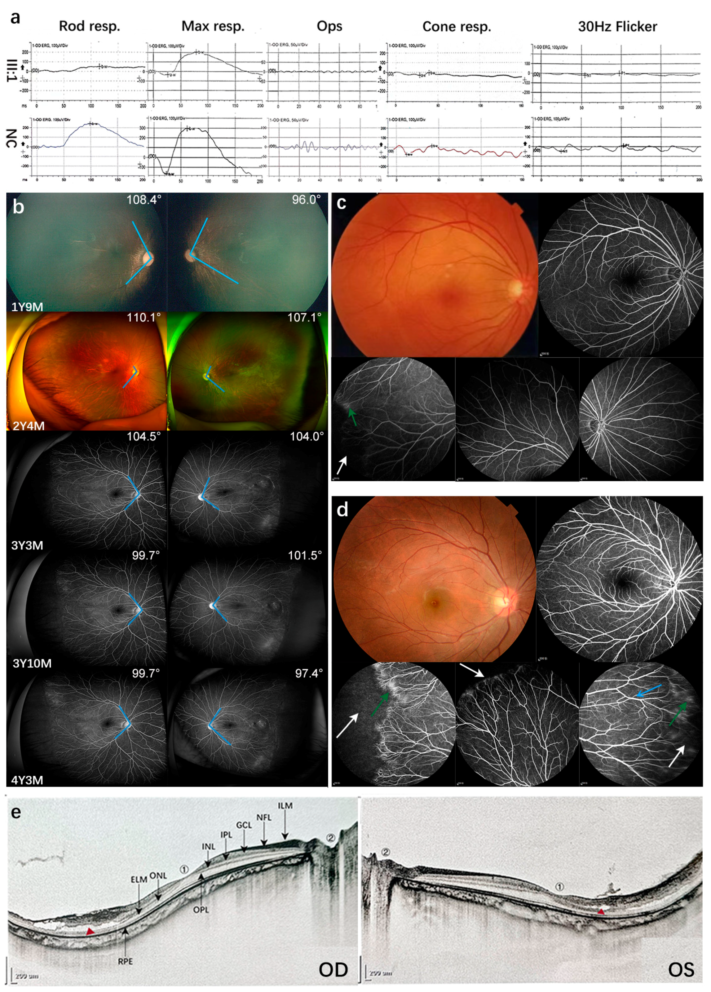 Genes 14 00587 g001 Genes 14 00587 g001