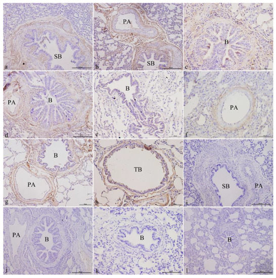 Genes | Free Full-Text | Distribution and Expression of Pulmonary Ionocyte-Related Factors CFTR, ATP6V0D2, and ATP6V1C2 in the... 