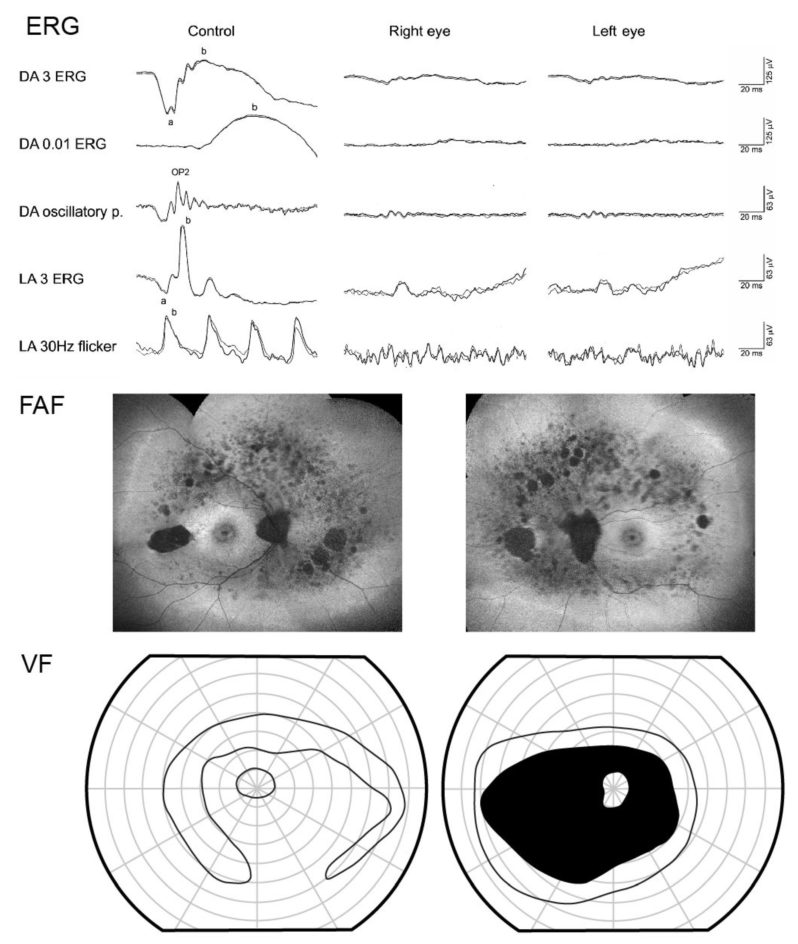 Genes 14 00652 g009 Genes 14 00652 g009