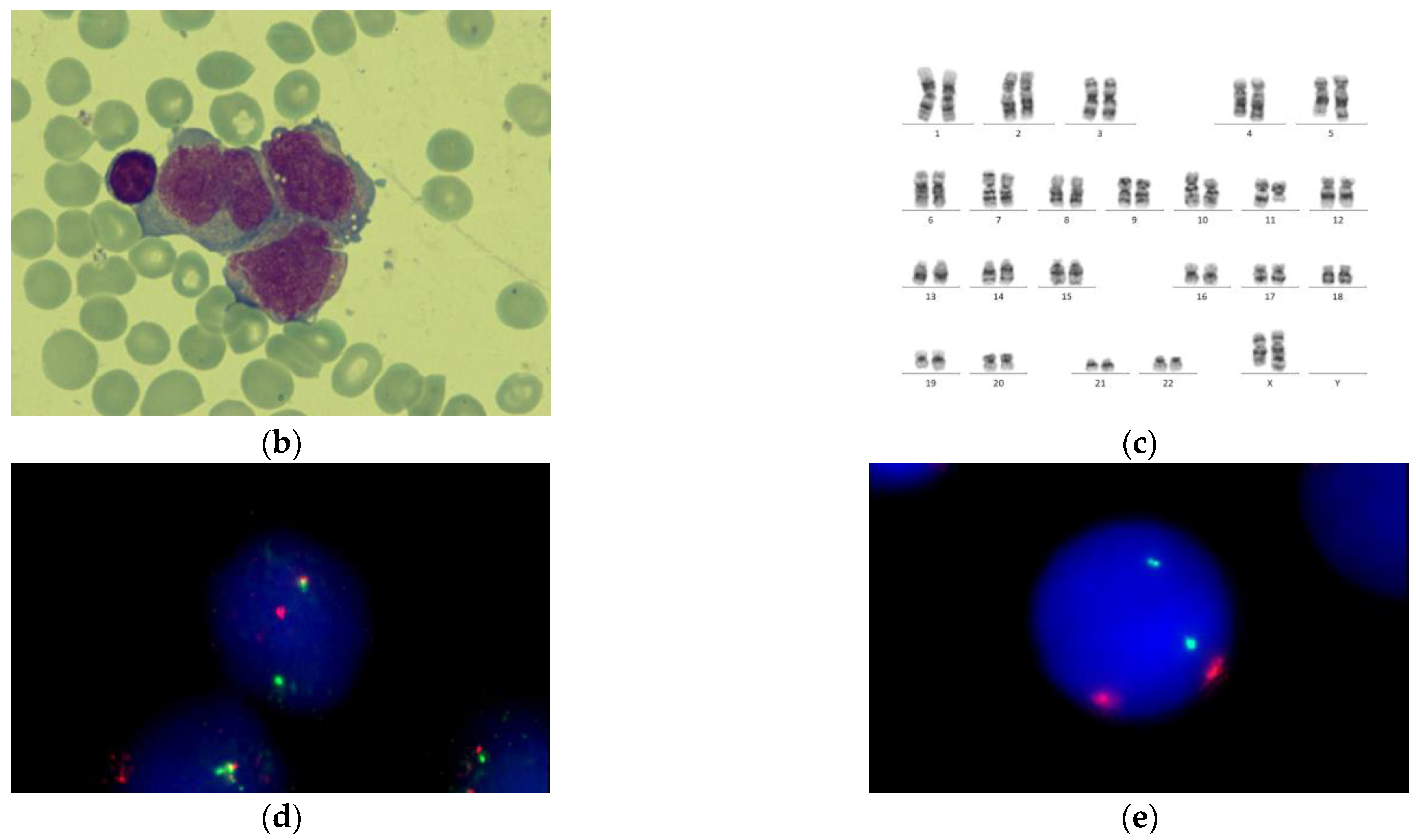 Genes 14 00675 g002b