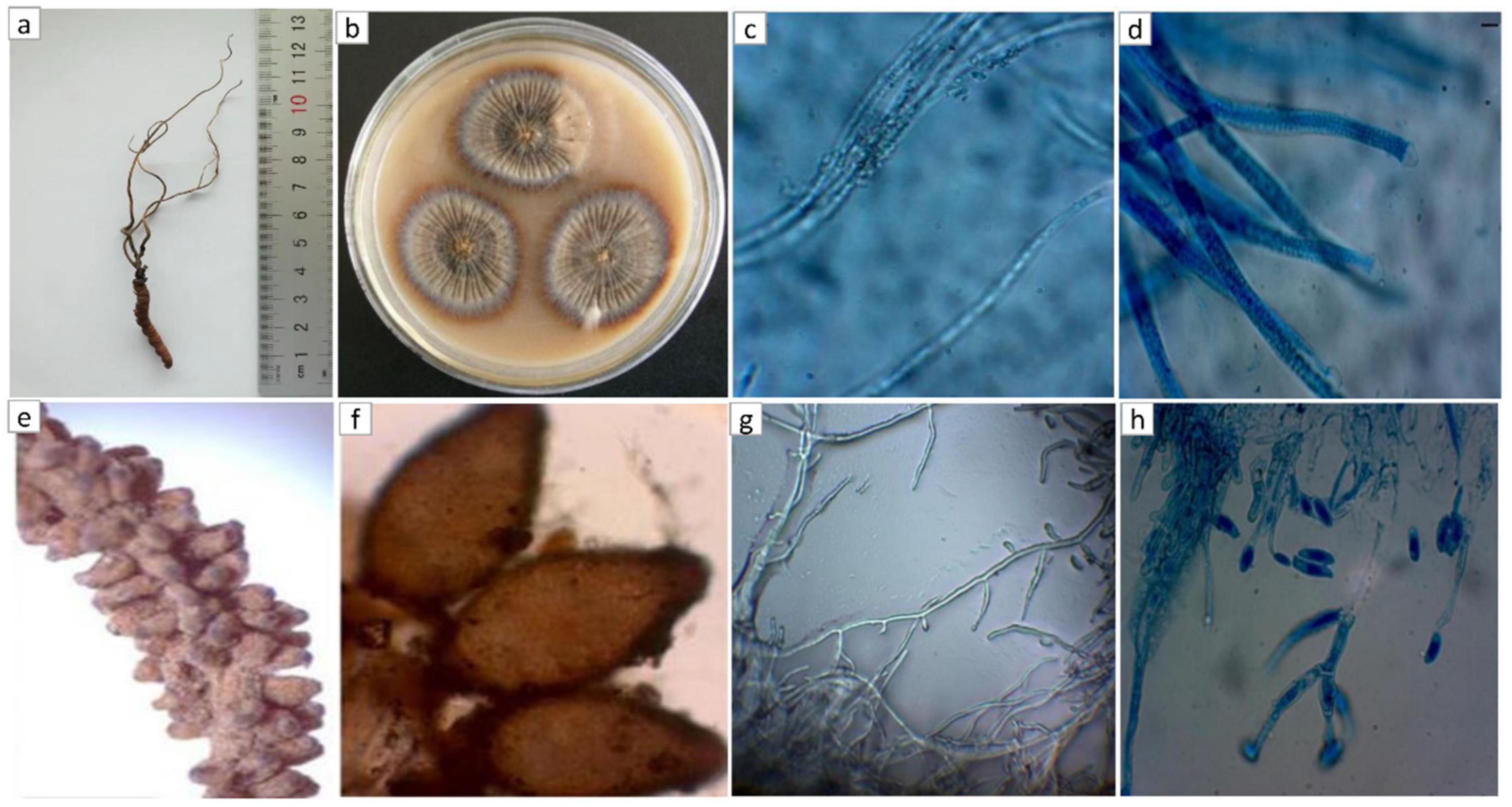 Genes 14 00710 g001 550