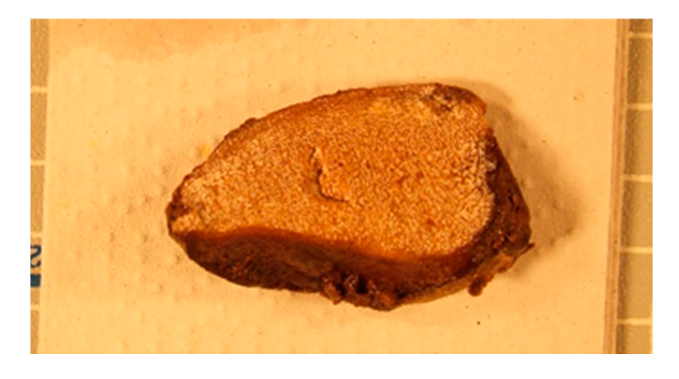 Genes 14 00851 g0a2 Genes 14 00851 g0a2