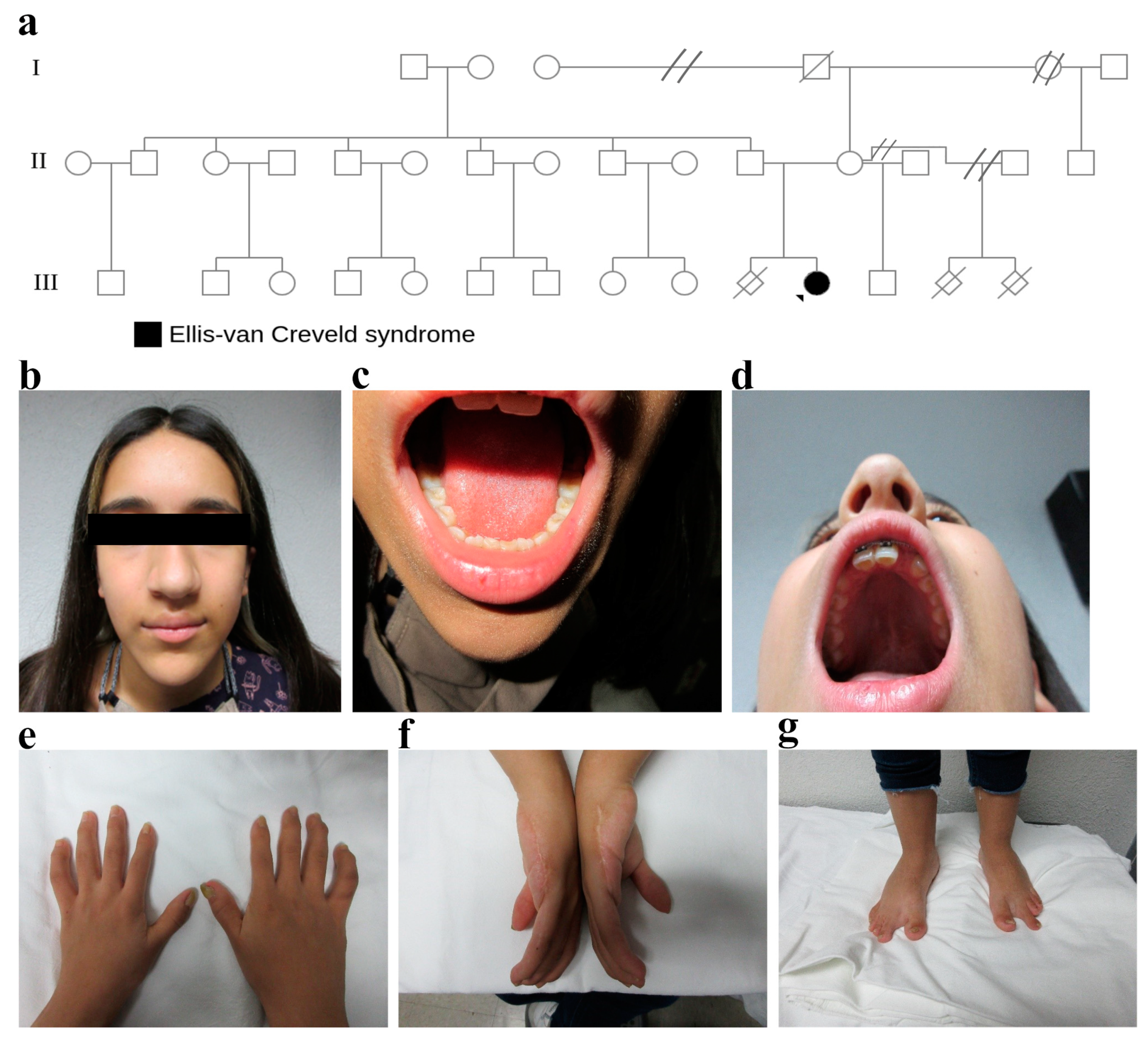 Genes 14 00887 g002 Genes 14 00887 g002