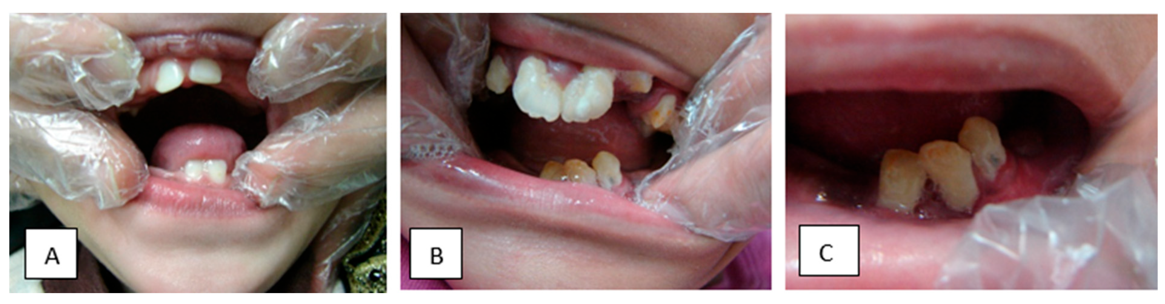 Genes 14 00900 g002 Genes 14 00900 g002