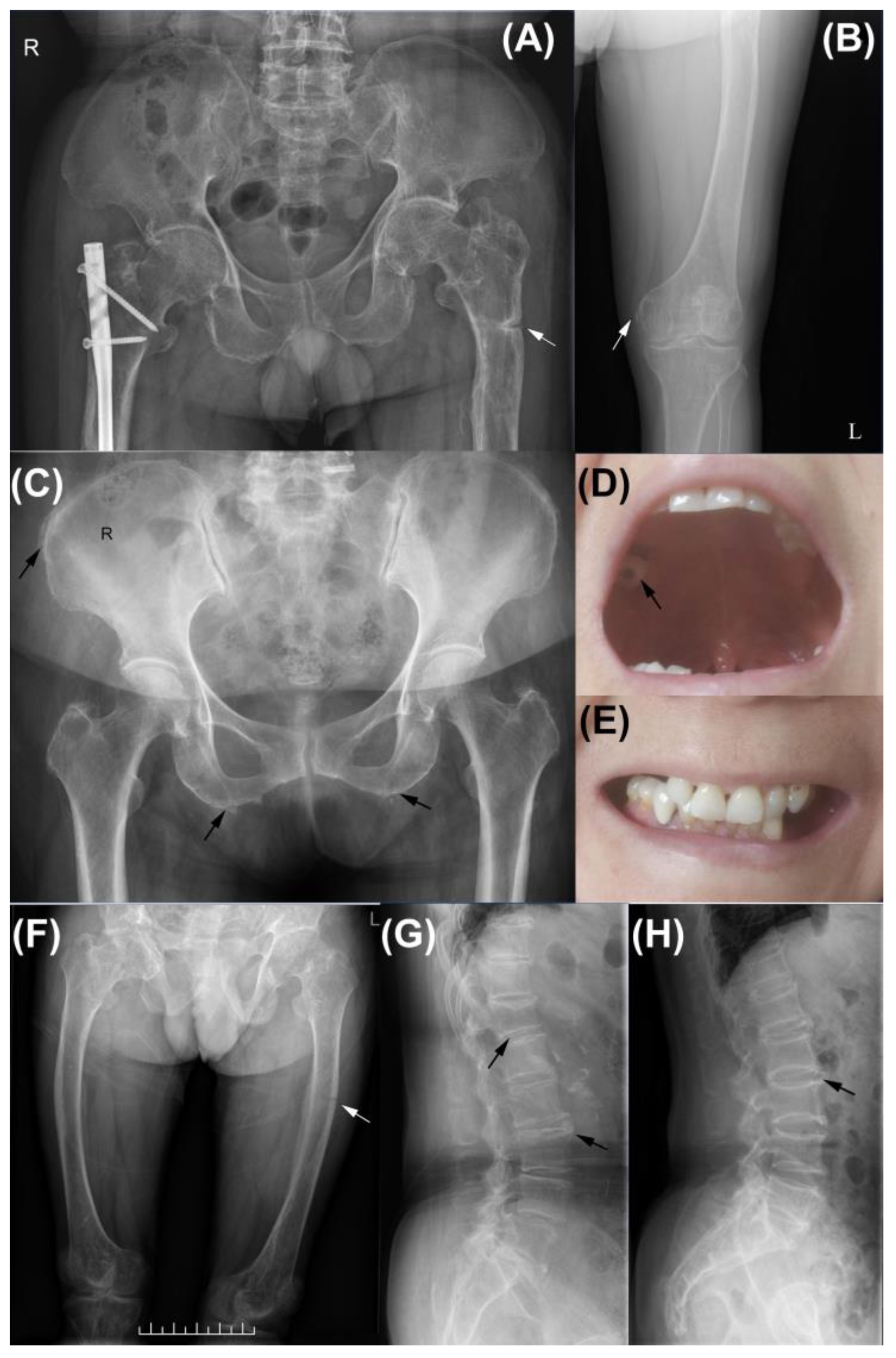 Genes 14 00922 g001 Genes 14 00922 g001