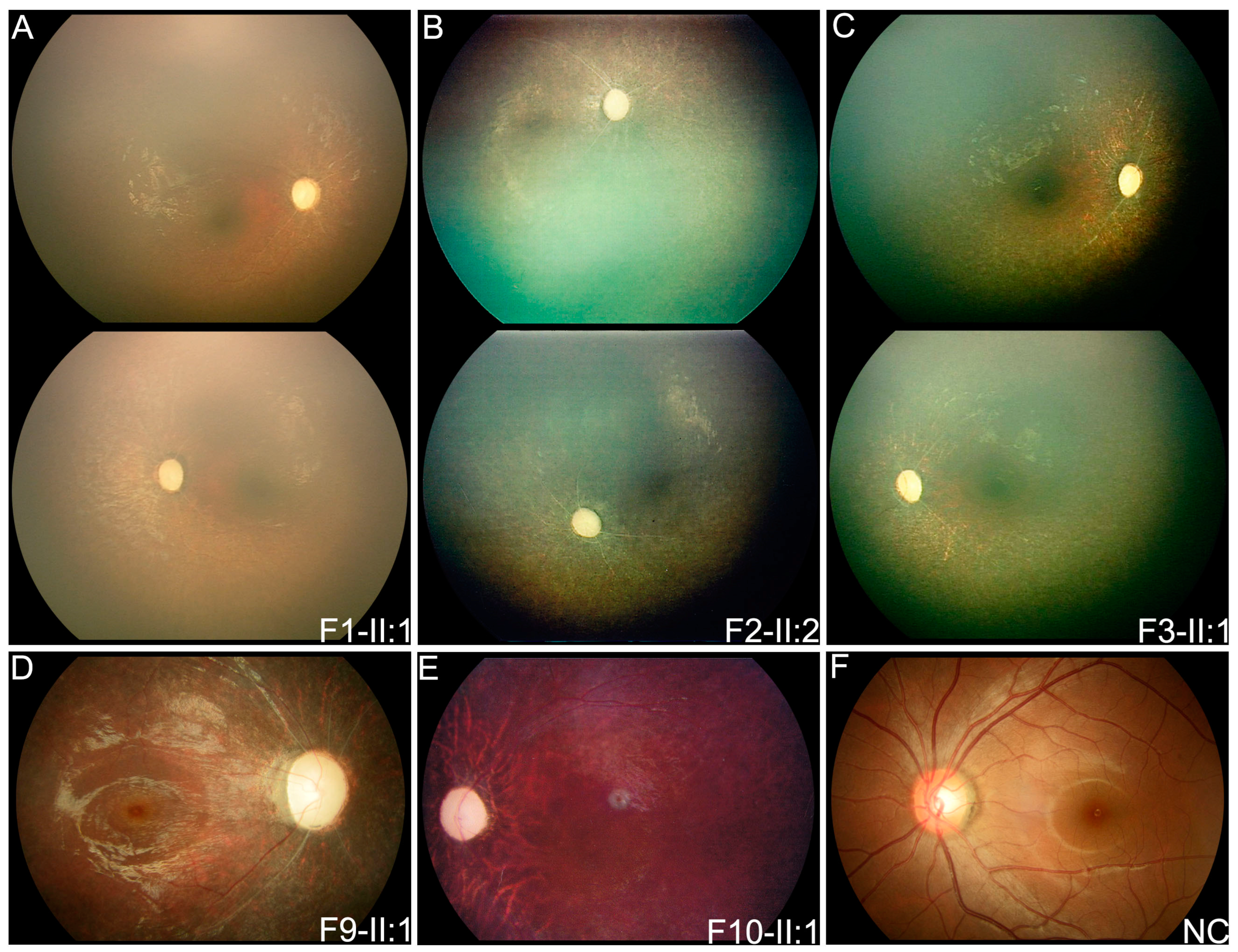 Genes 14 00952 g002 Genes 14 00952 g002