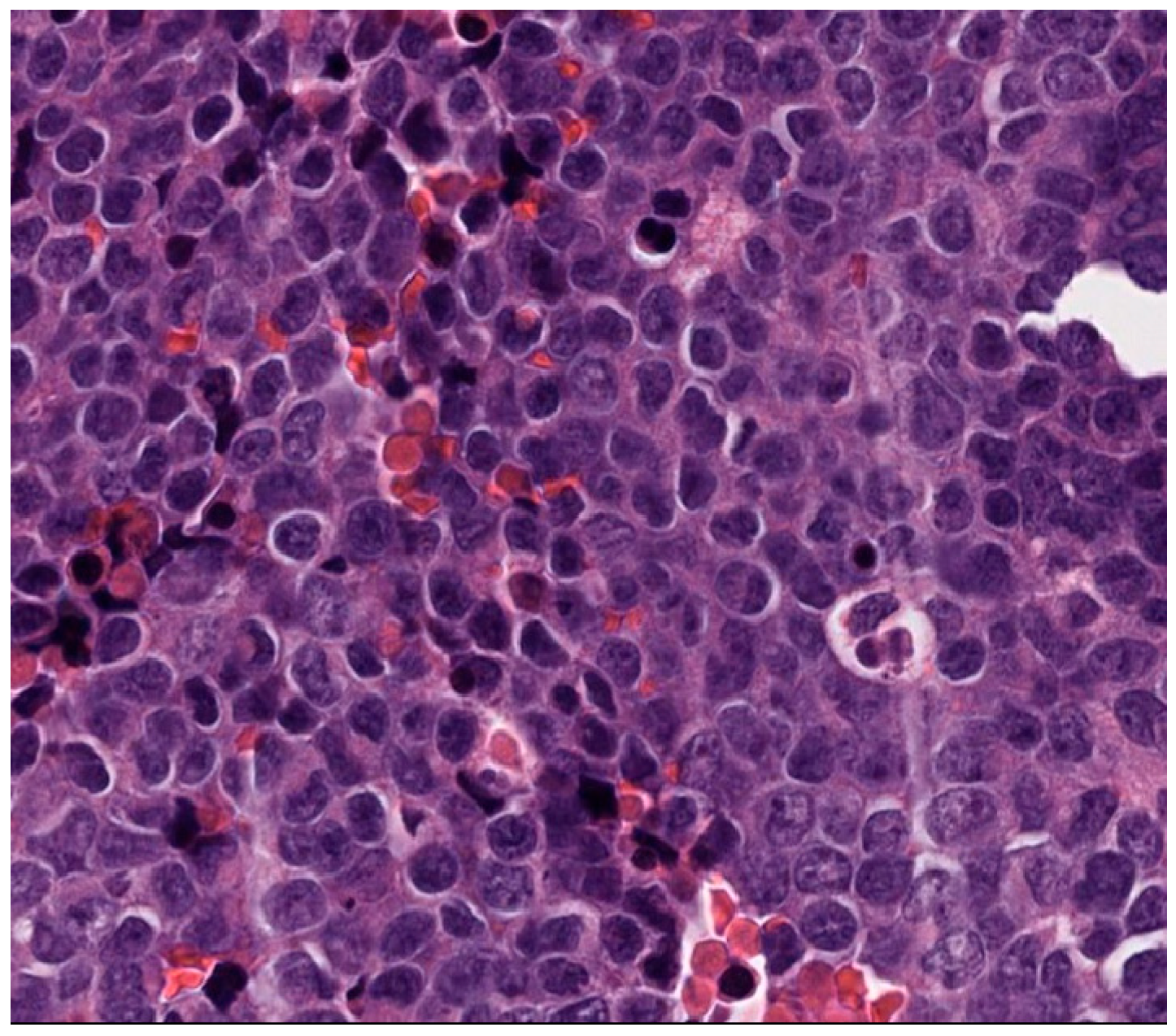 洋書 MORPHOGENESIS Snap29 mutant mice recapitulate neurological and