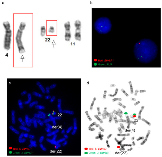 Genes Free FullText Complex/cryptic EWSR1FLI1/ERG Gene Fusions