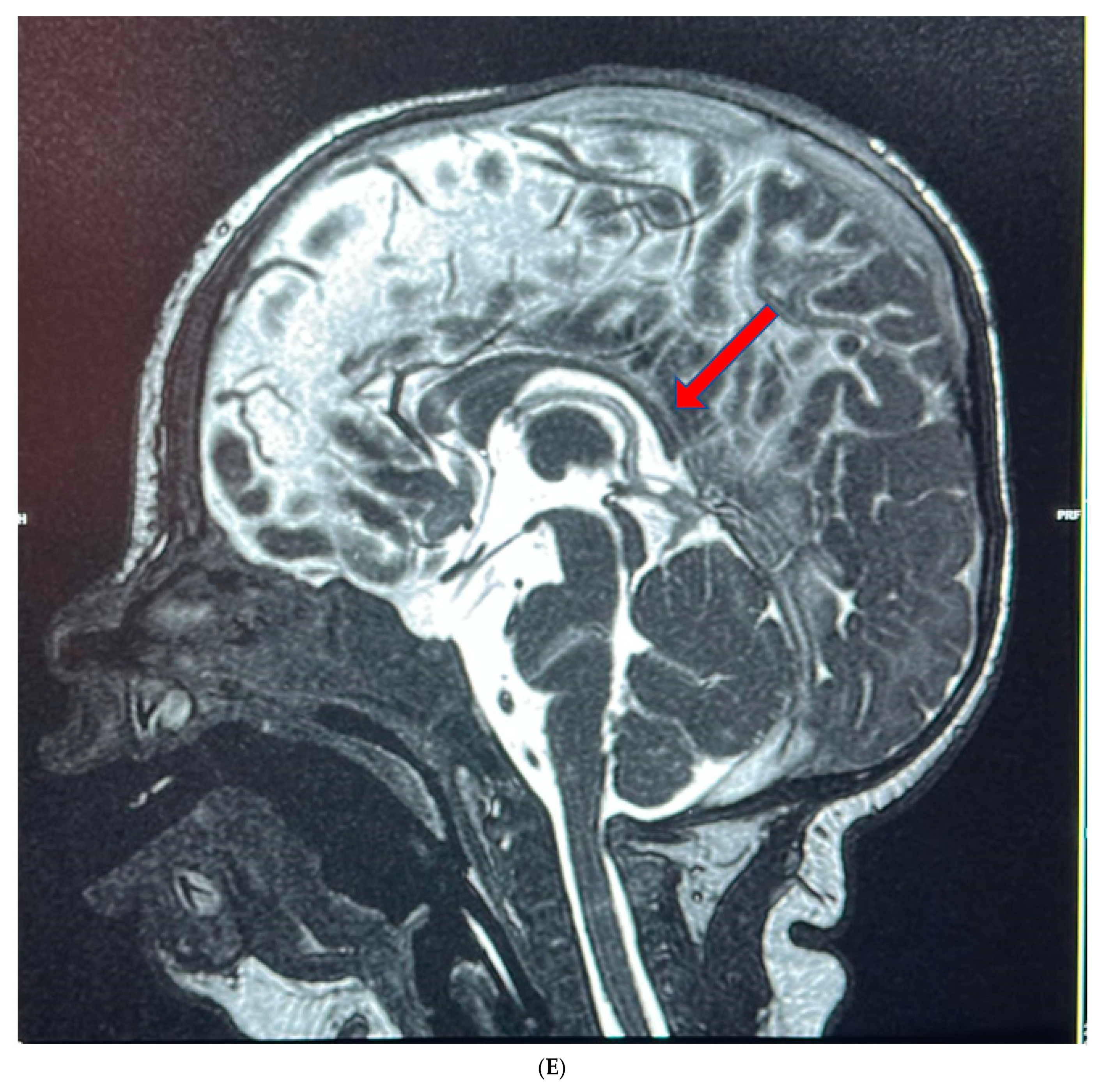 Genes 14 01225 g001b Genes 14 01225 g001b