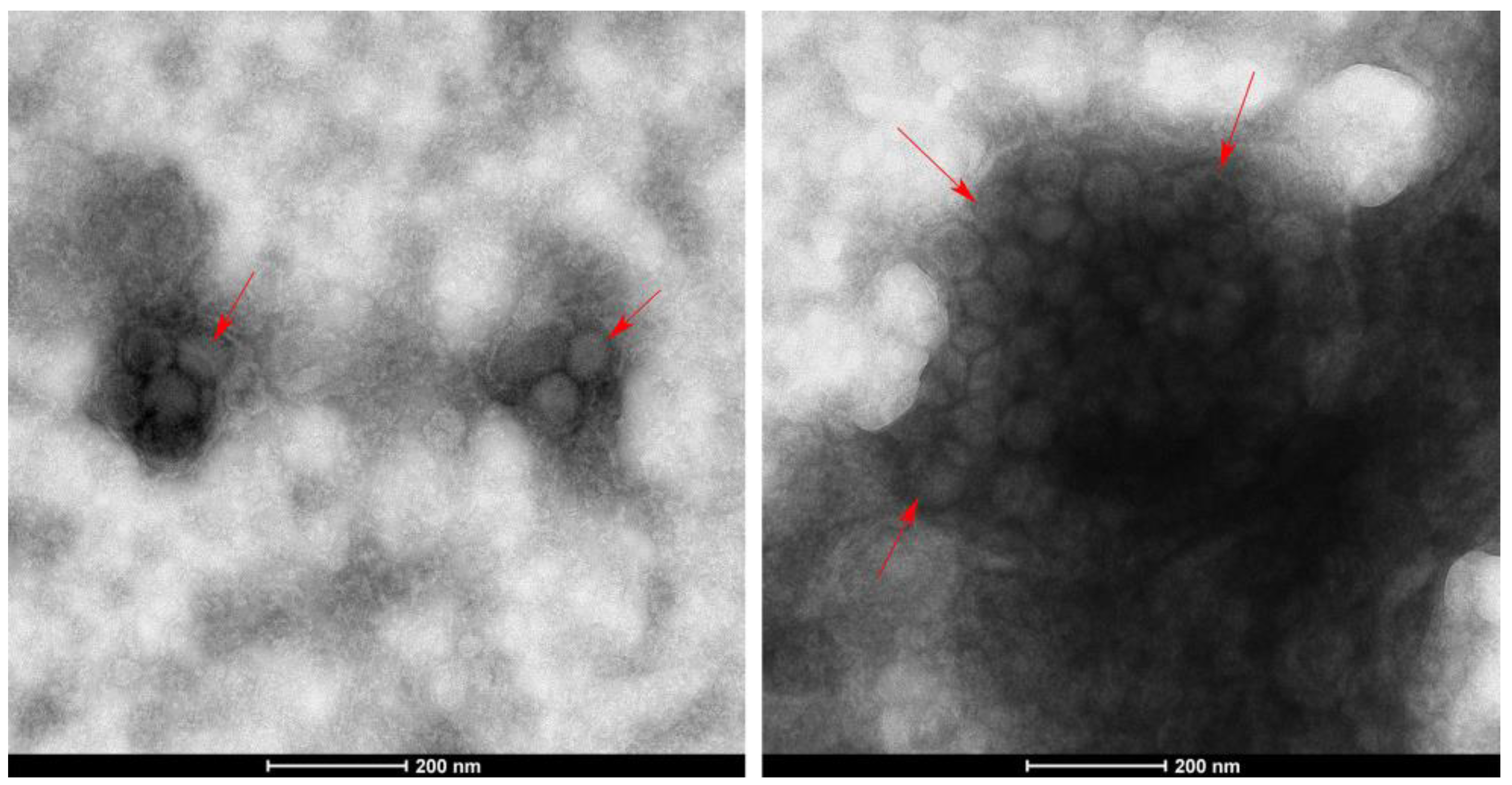 Genes 14 01788 g002 Genes 14 01788 g002