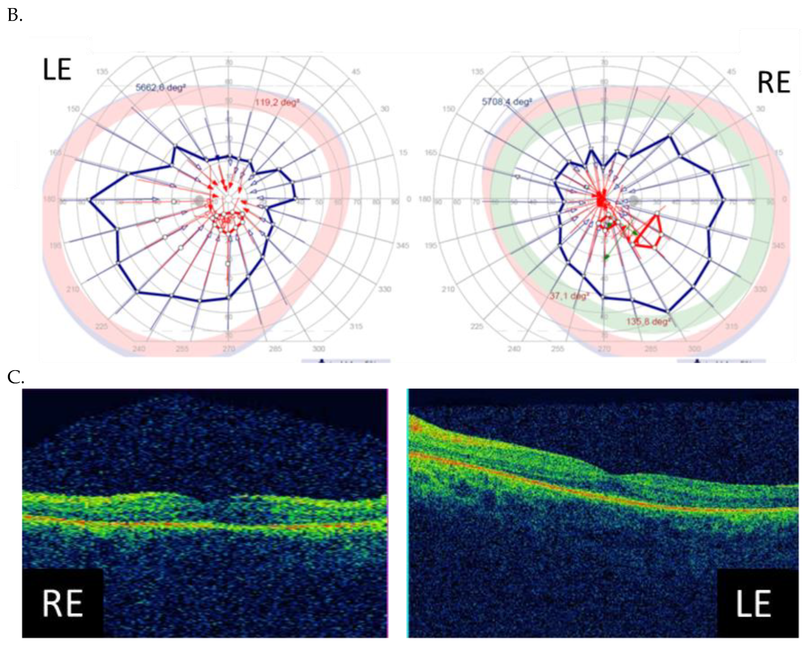 Genes 14 01950 g004b