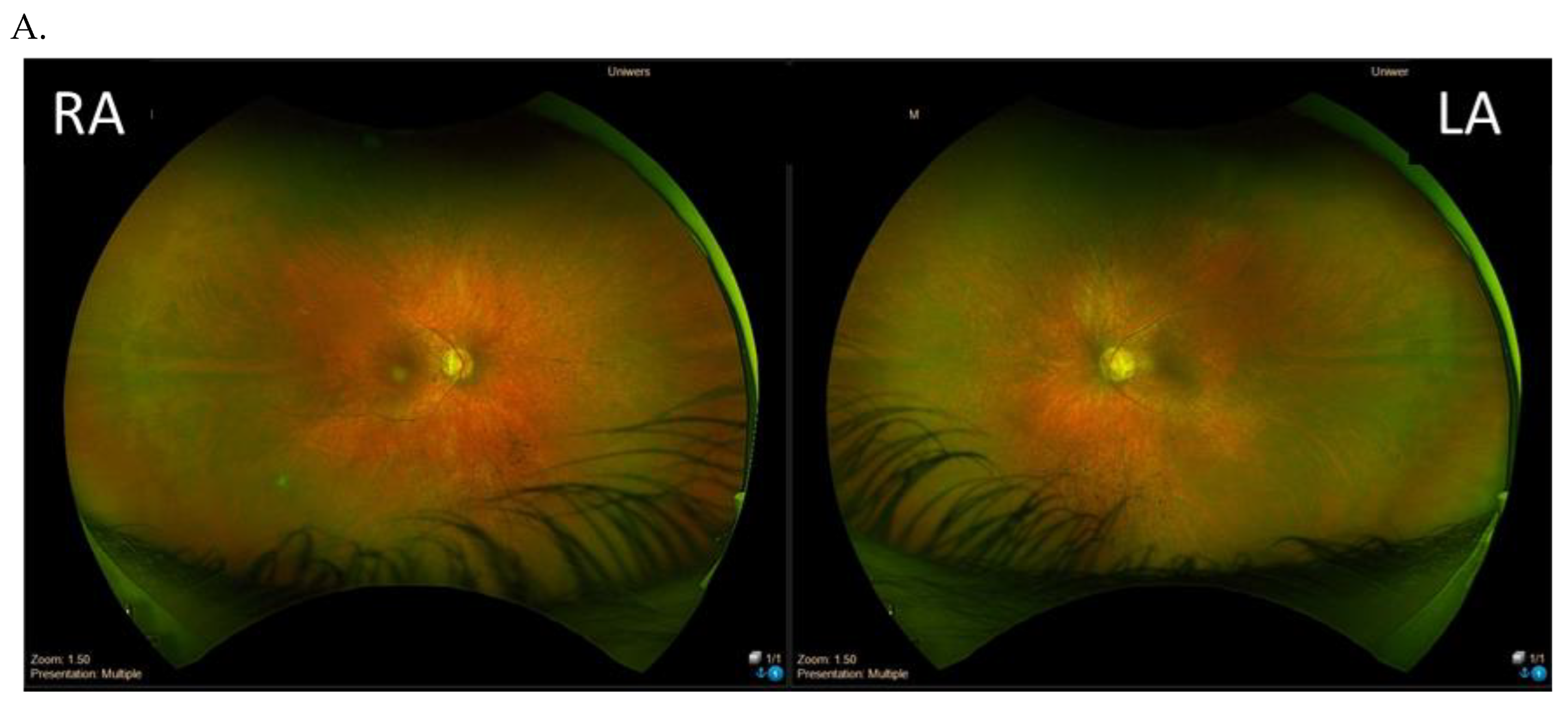 Genes 14 01950 g005a