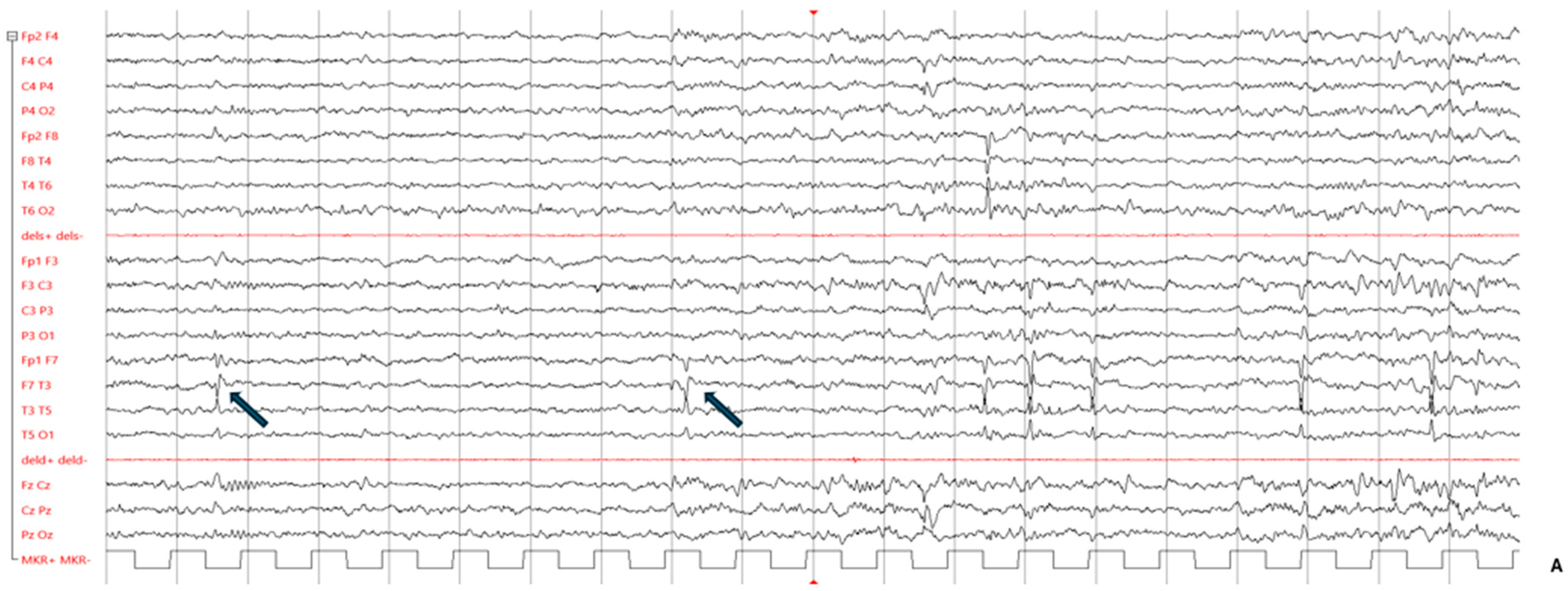 Genes 15 00548 g002a
